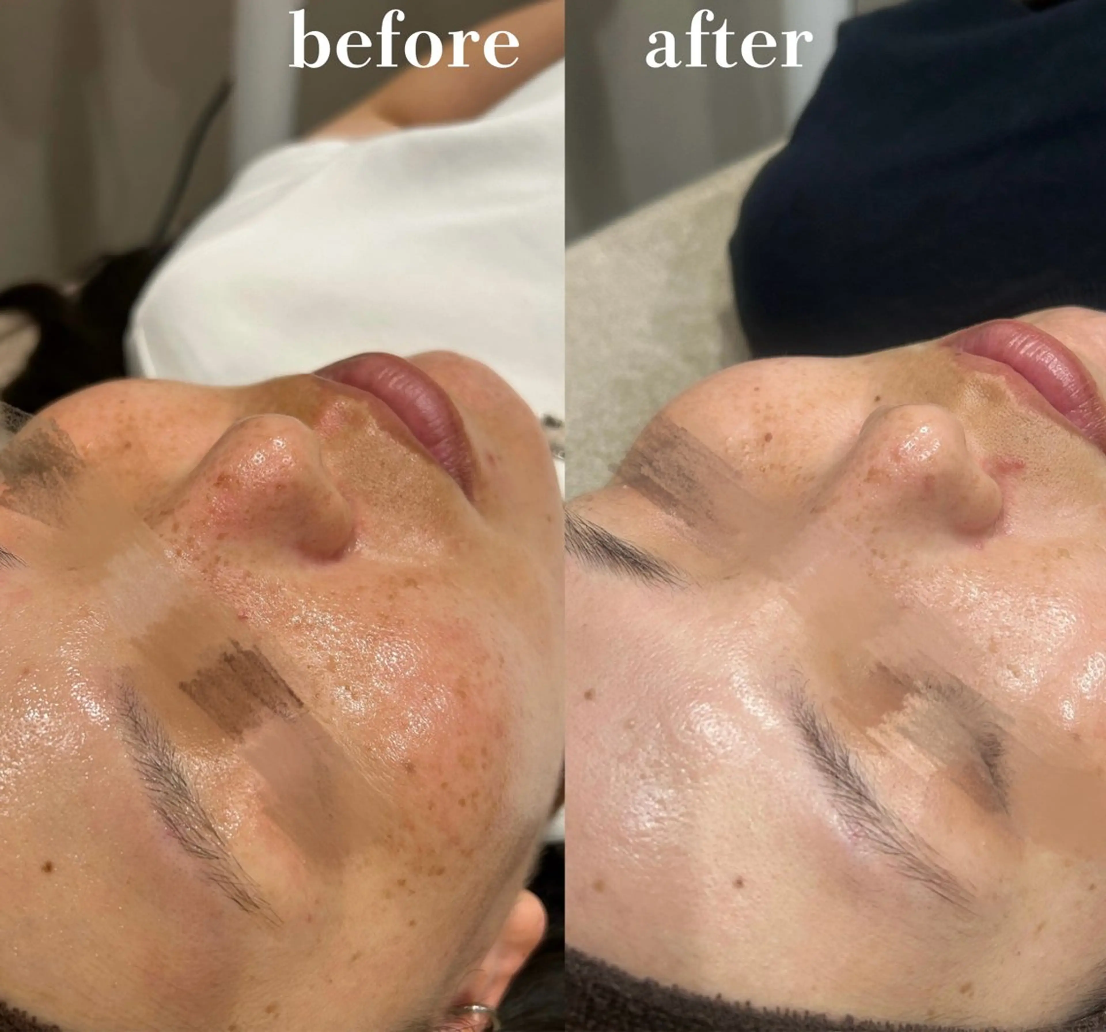 LUMIERE(ルミエル)福岡春吉店所属・LUMIERE 福岡のエステ・リラクイメージ