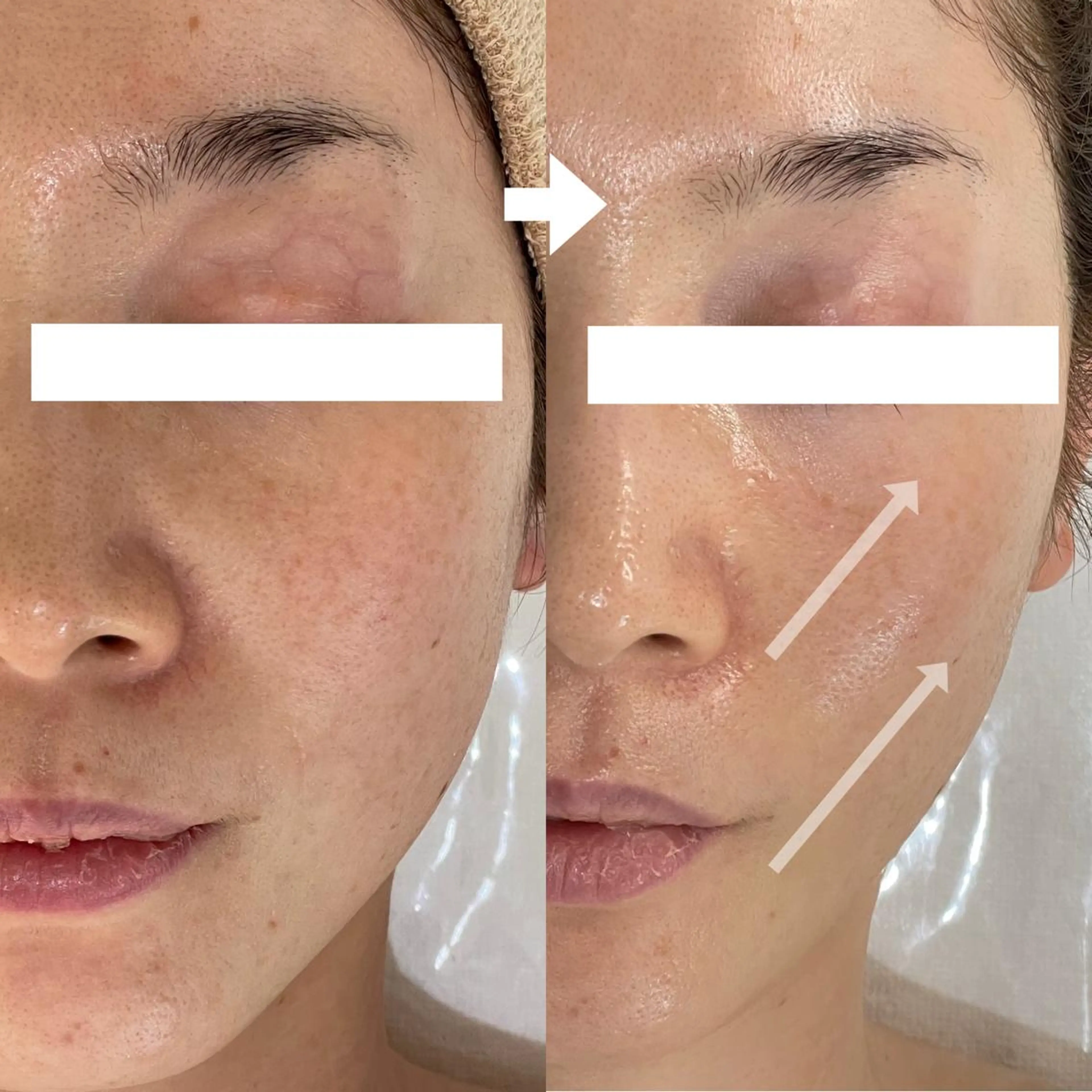 ニキビ・毛穴・ フェイシャル専門店のエステ・リラクイメージ