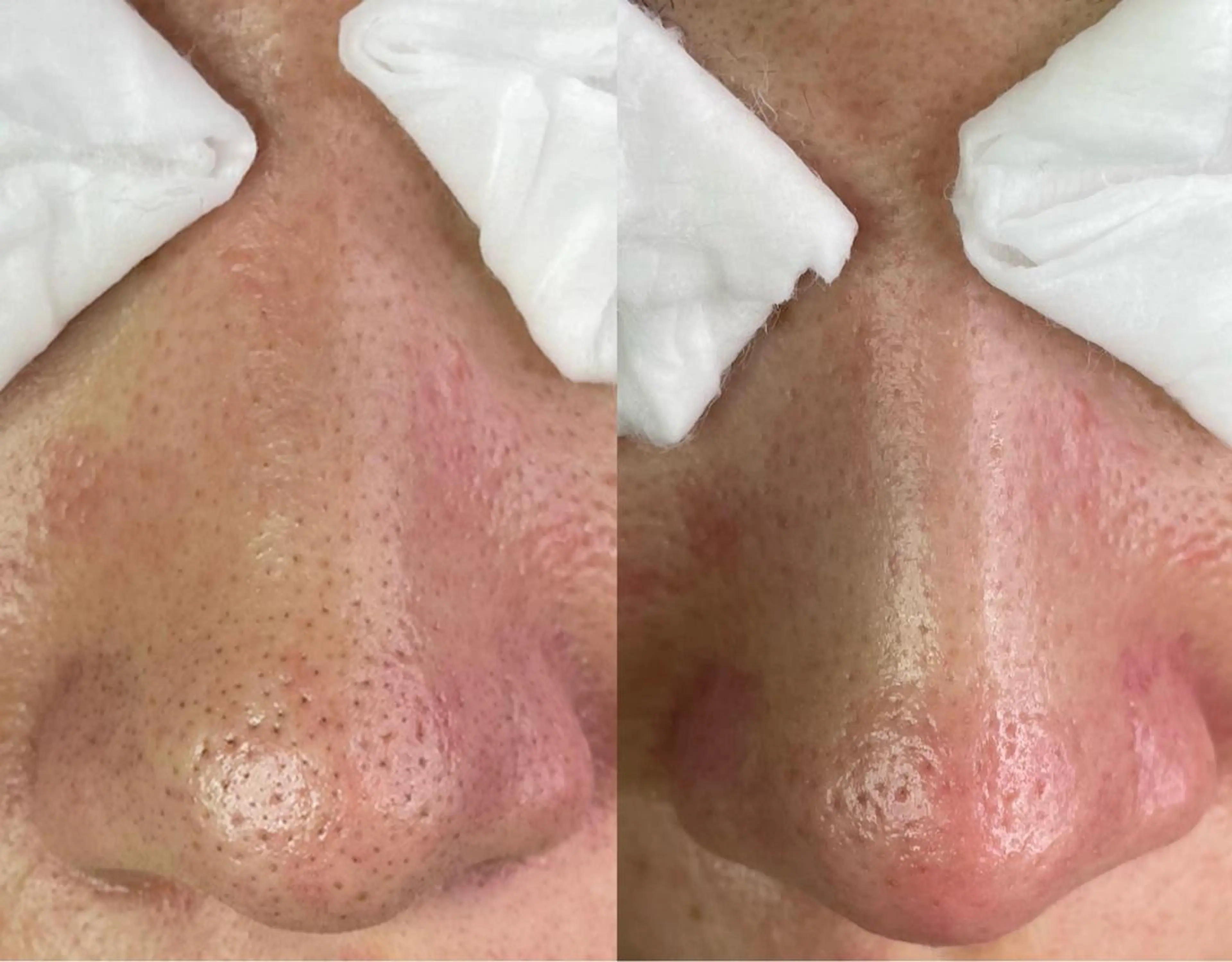 エステ 大久保 里奈のエステ・リラクイメージ