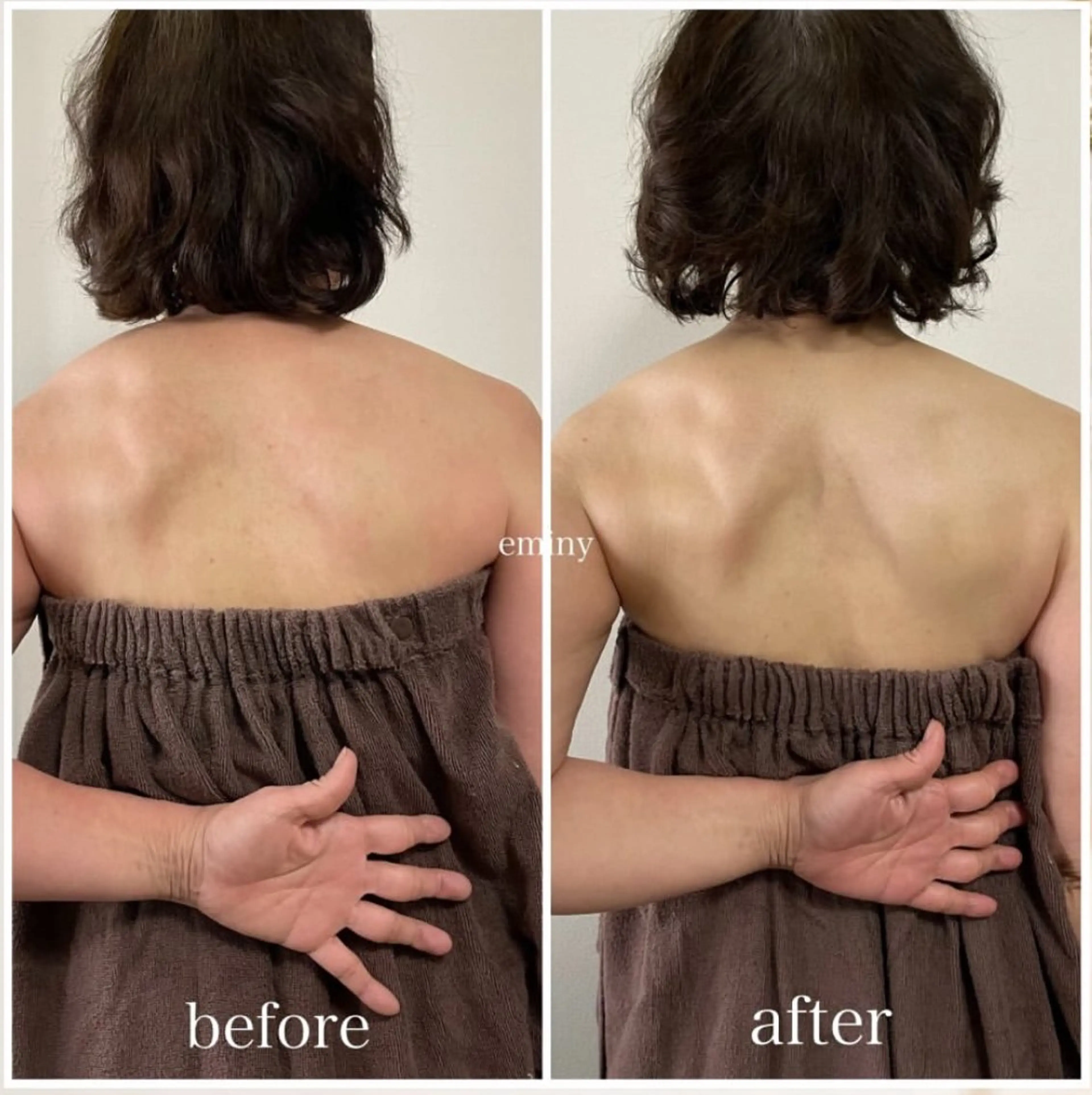 リンパトリートメント60分の写真