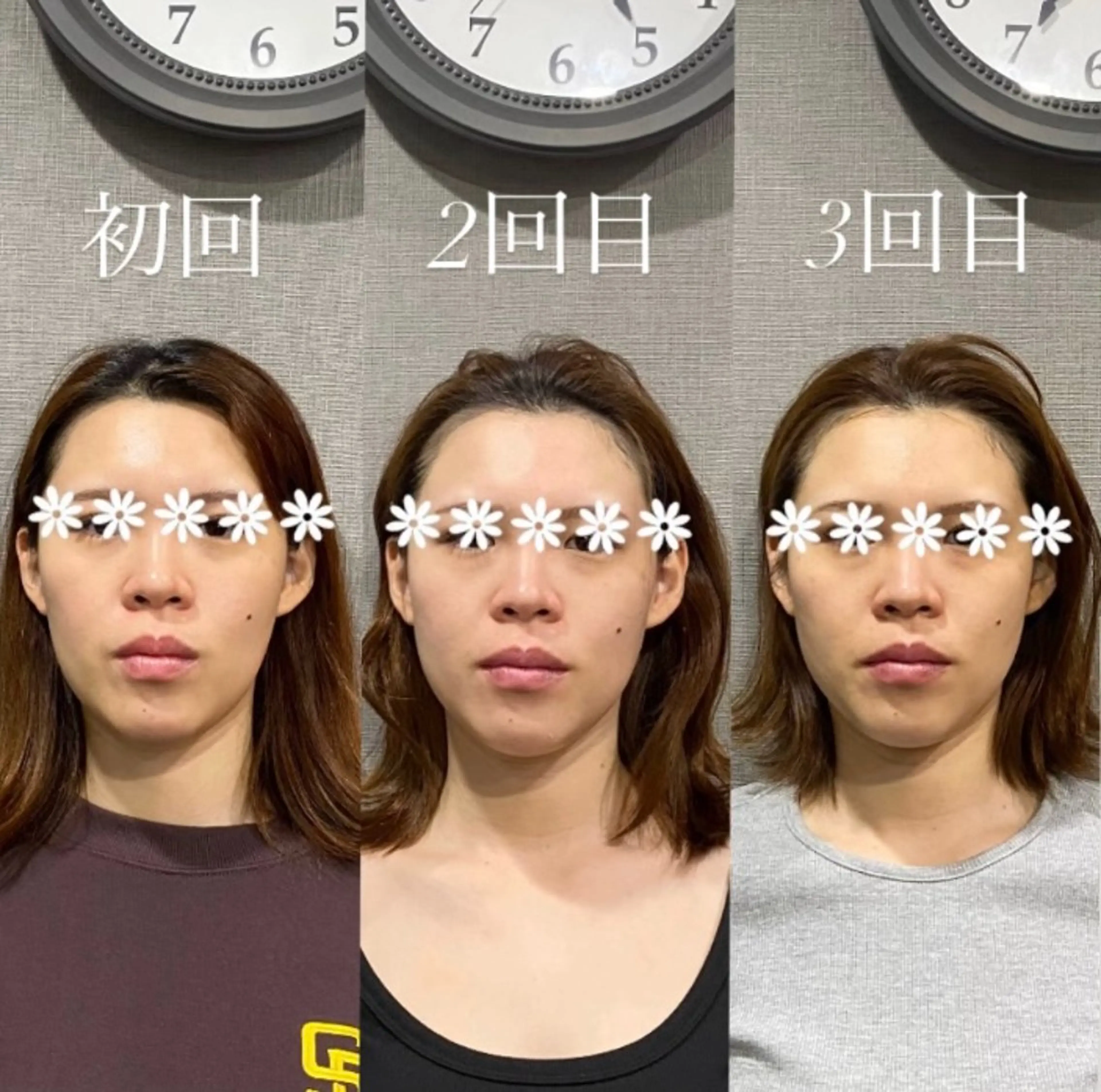 エステ リラク 肌質改善専門 ハーブ /毛穴洗浄 リエイトのエステ・リラクイメージ