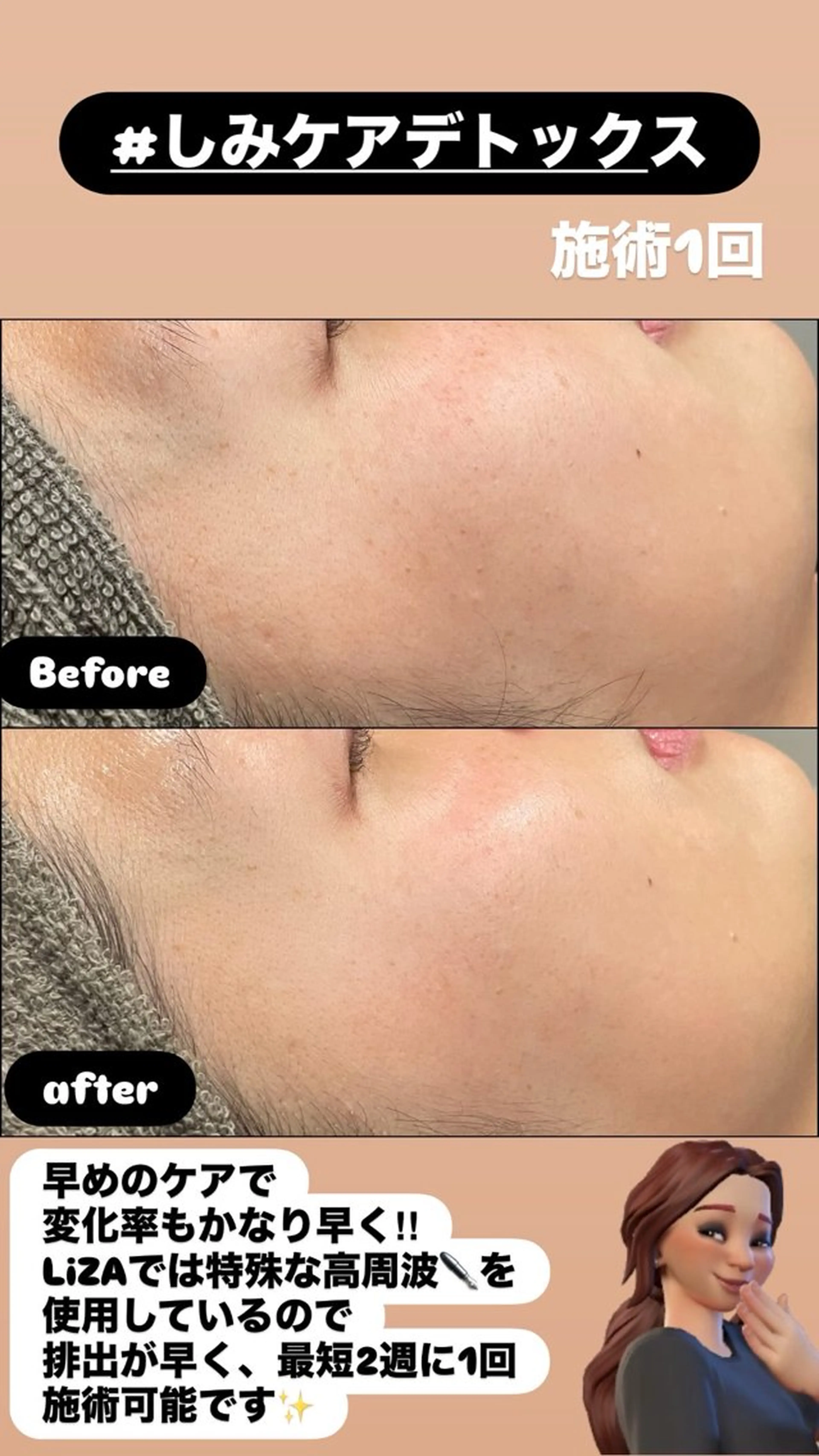 エステ LiZA エステティックサロンのエステ・リラクイメージ