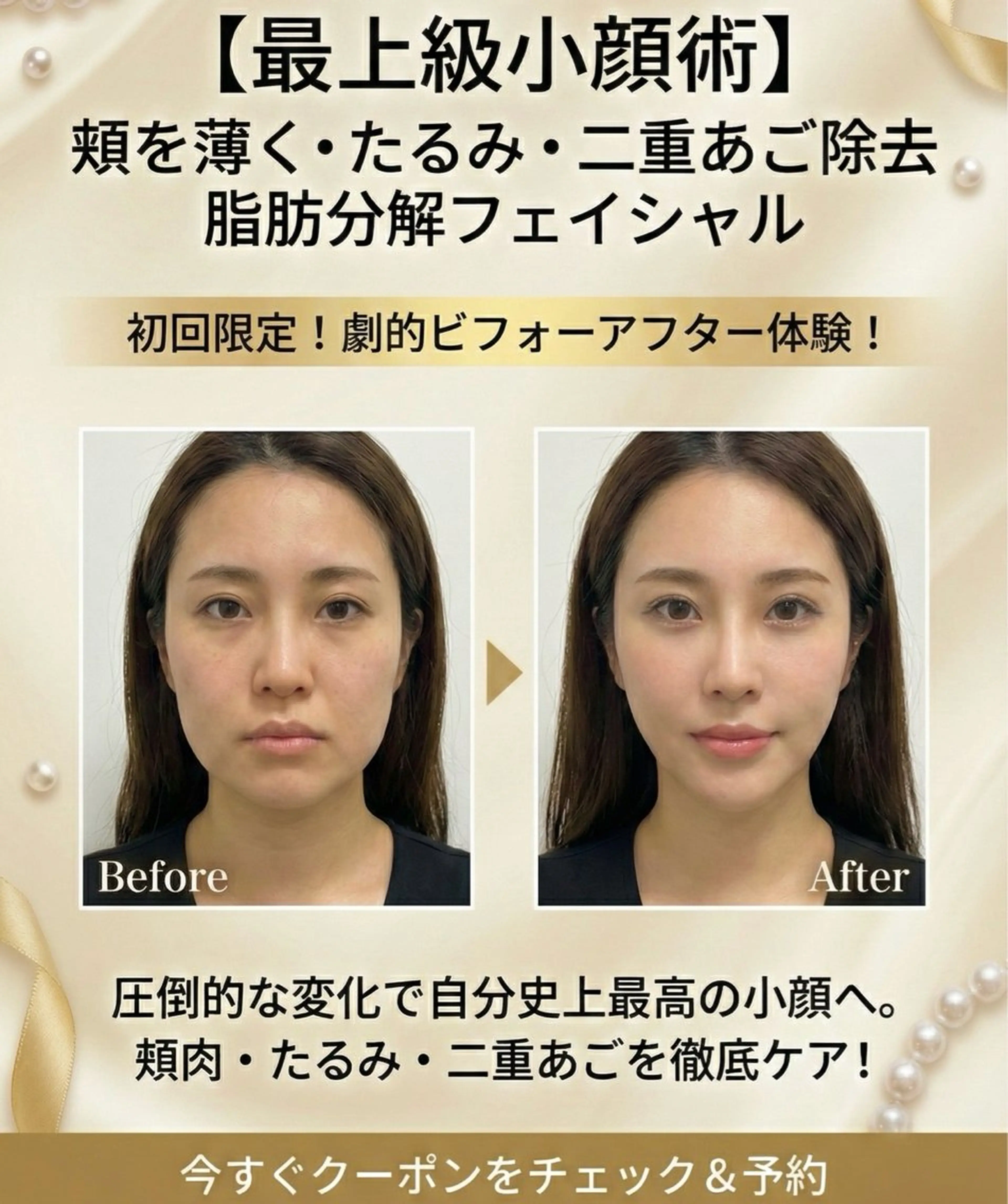 【頬肉撃退】高濃度・脂肪激減×強力リフト矯正|二重アゴ・ほうれい線・ブルドッグ顔を消滅【施術50分〜】の写真