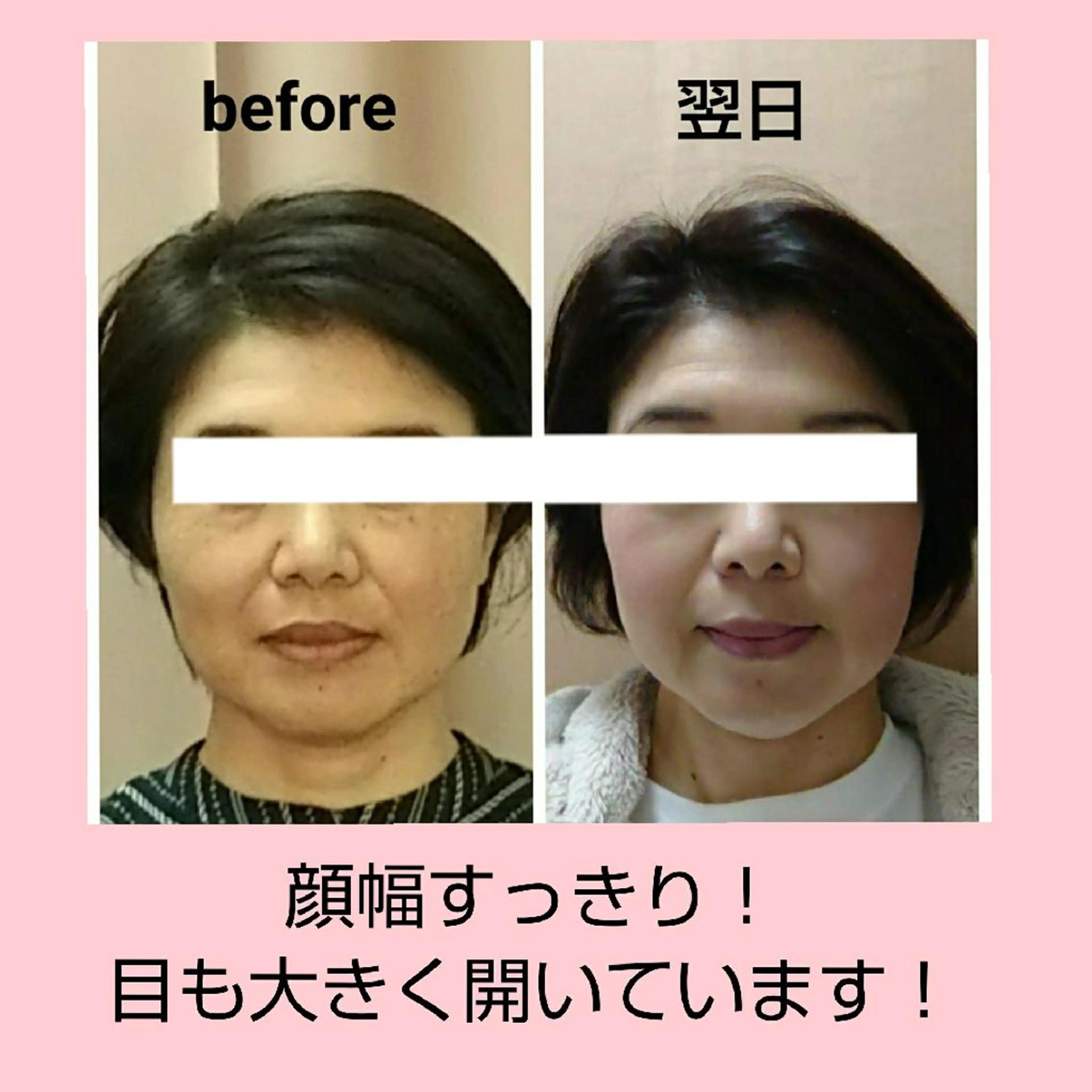 小顔と美肌 まごころエステMatoria所属・小顔 美肌専門 Matoriaのエステ・リラクイメージ