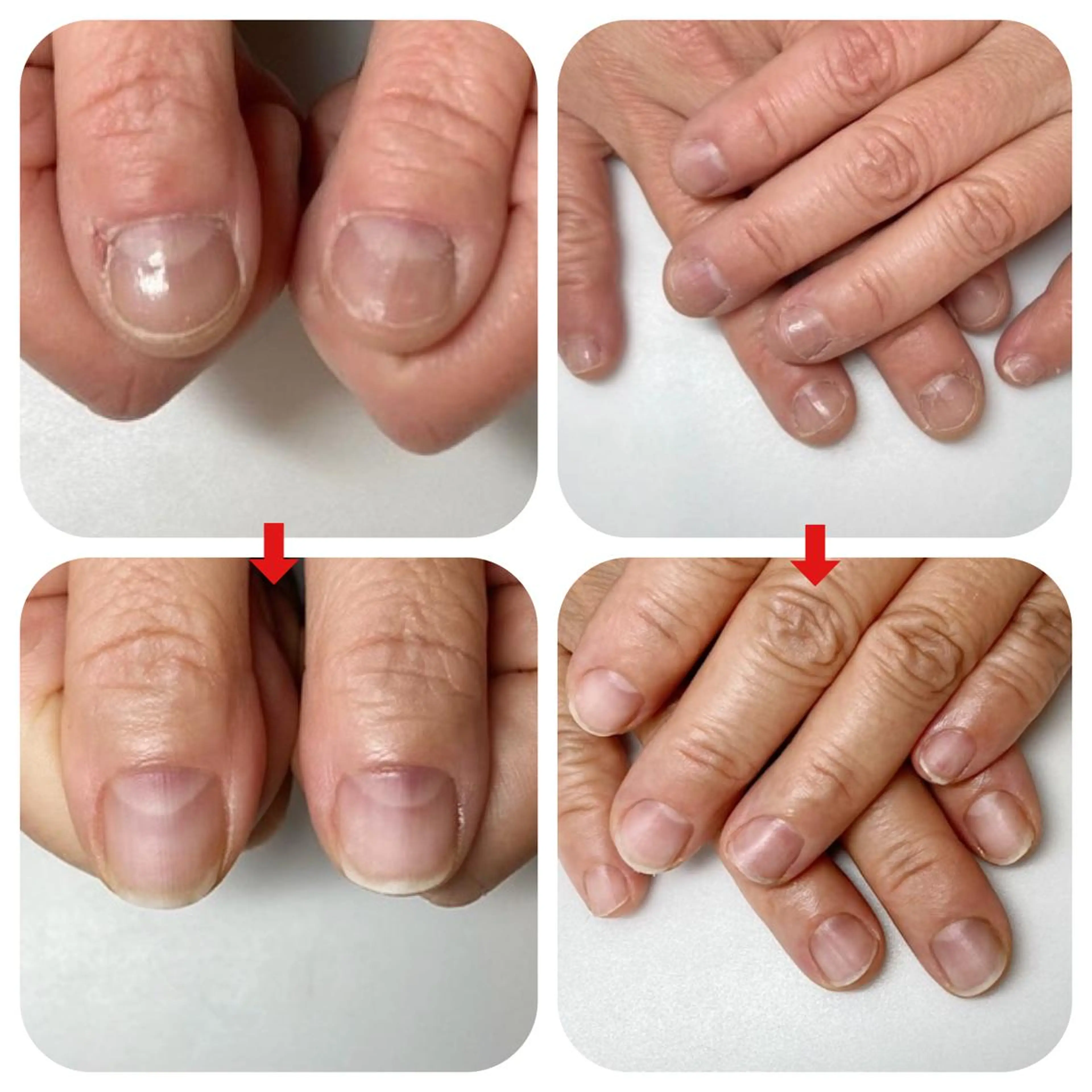 ネイル ネイルサロン アリュームのネイルデザイン