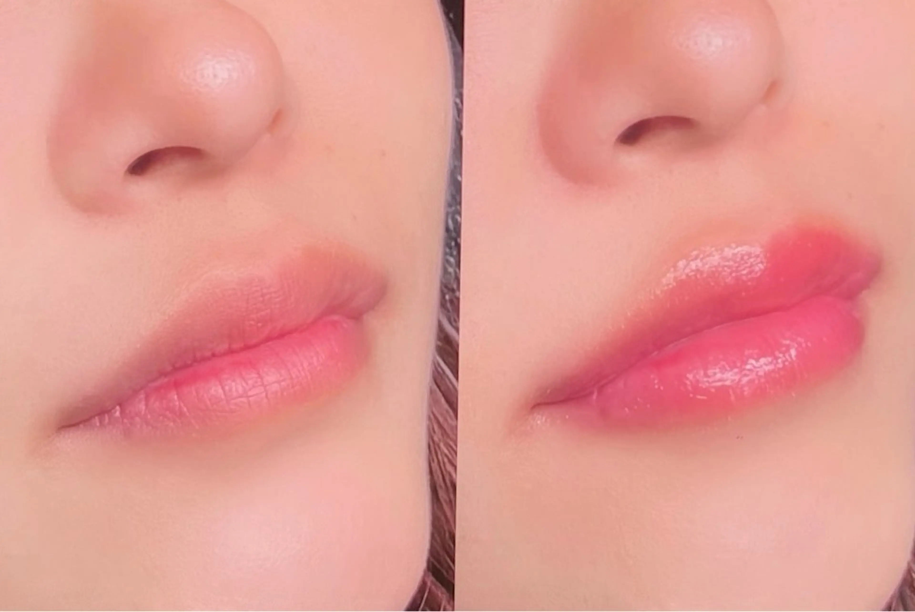 メラニンケア⭐️LALA PINKモニター(リップ)の写真