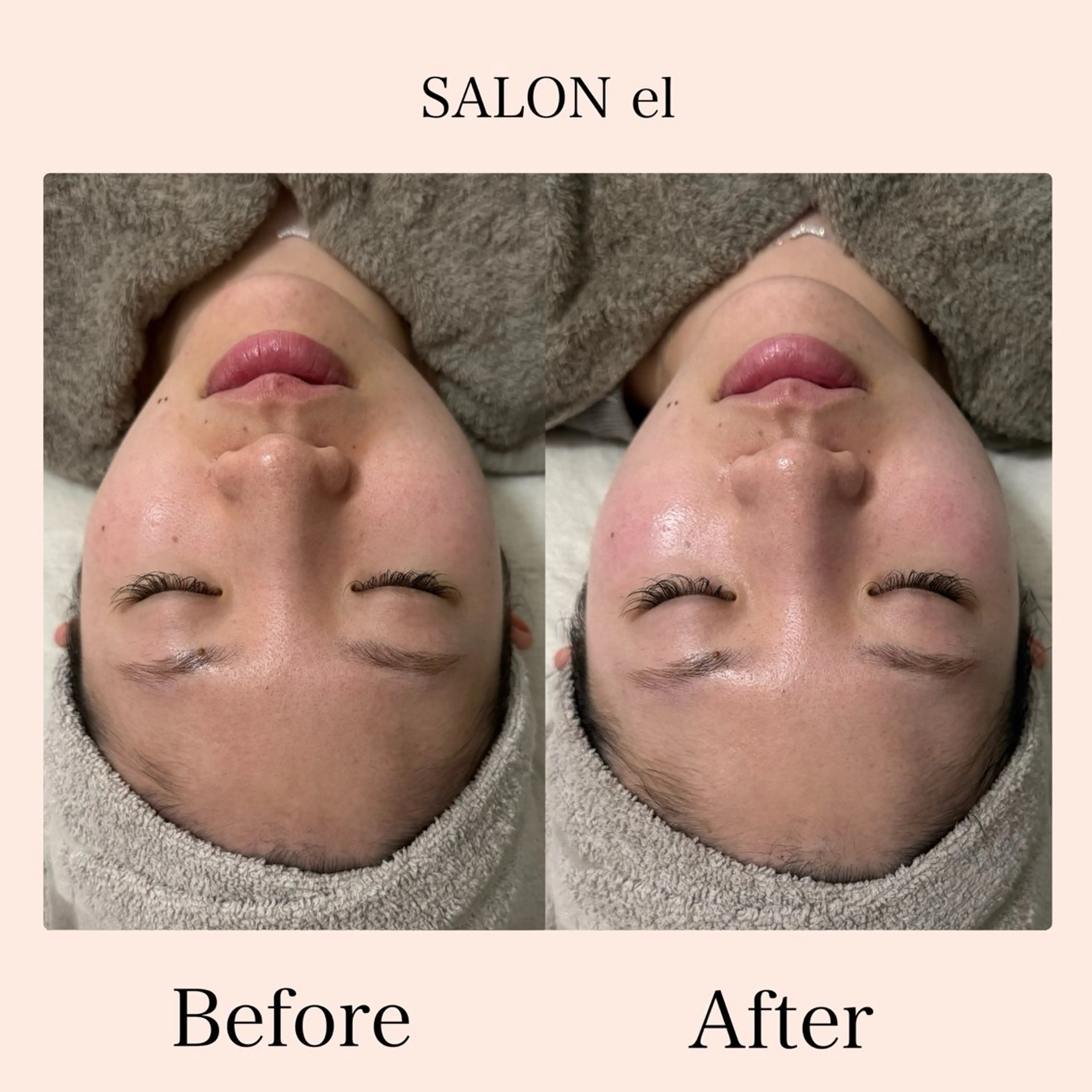エステ SALON el KARINのエステ・リラクイメージ