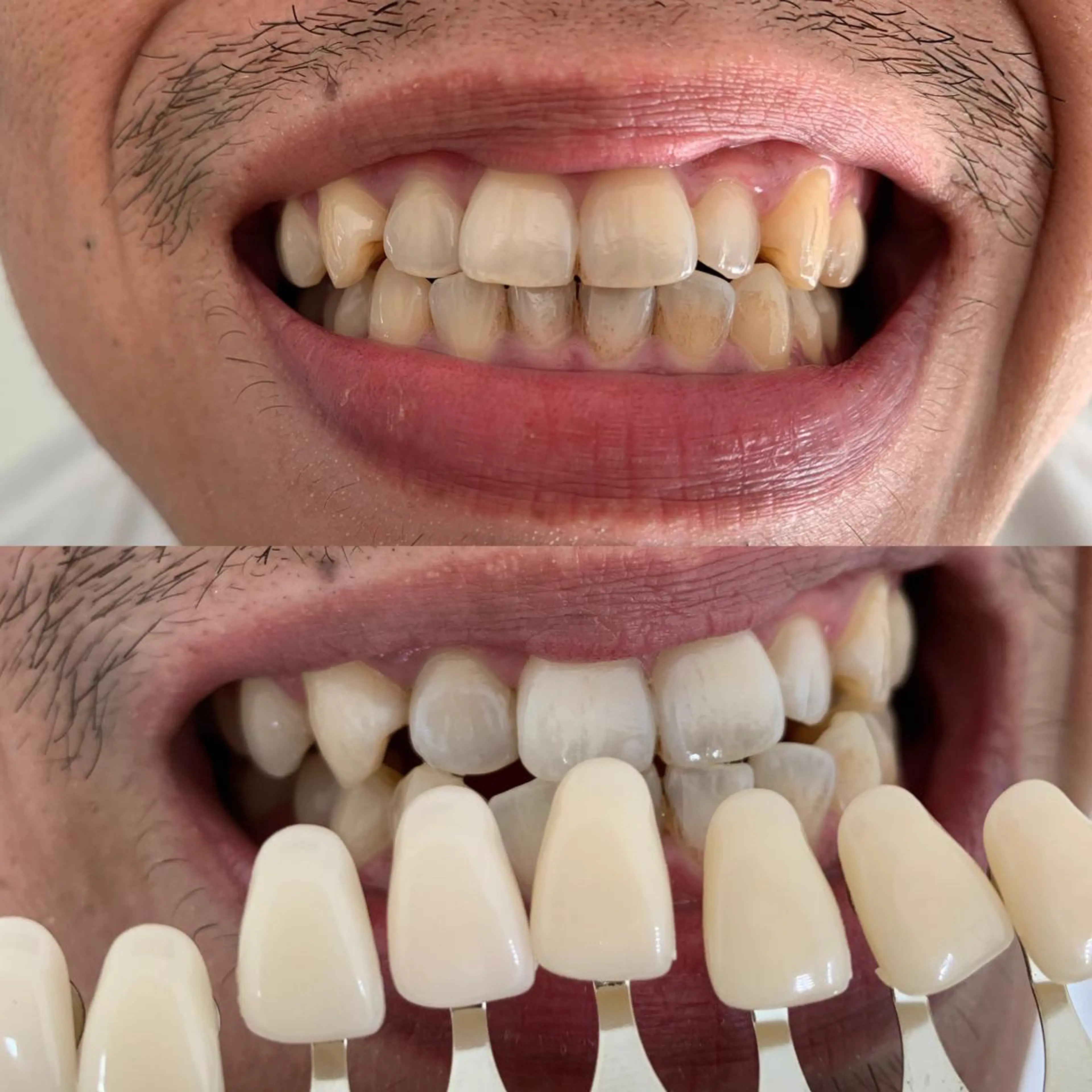 217whitening  room所属・217 ホワイトニングルームのエステ・リラクイメージ