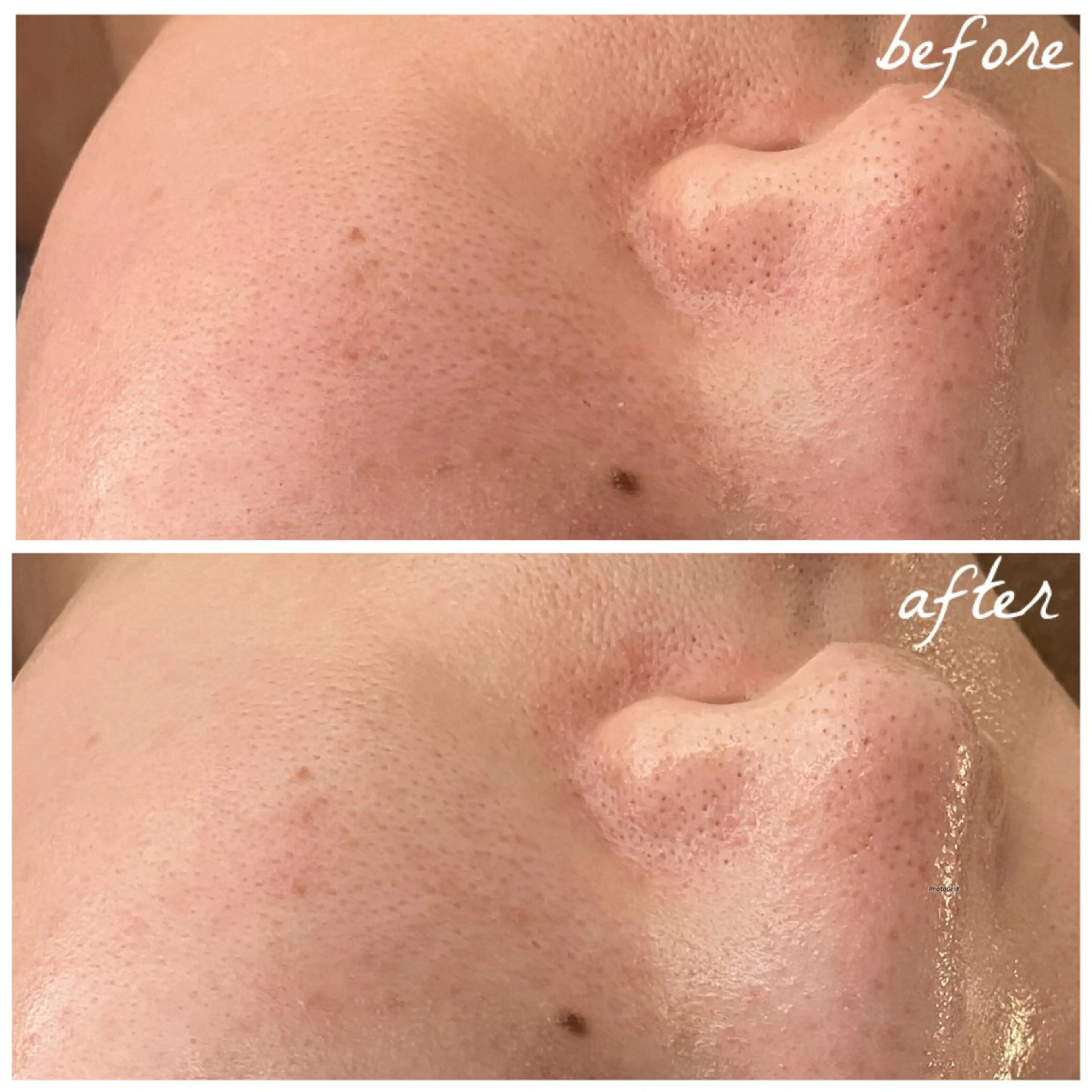 メンズ エステ メナード岐阜市茜部 杉浦のエステ・リラクイメージ