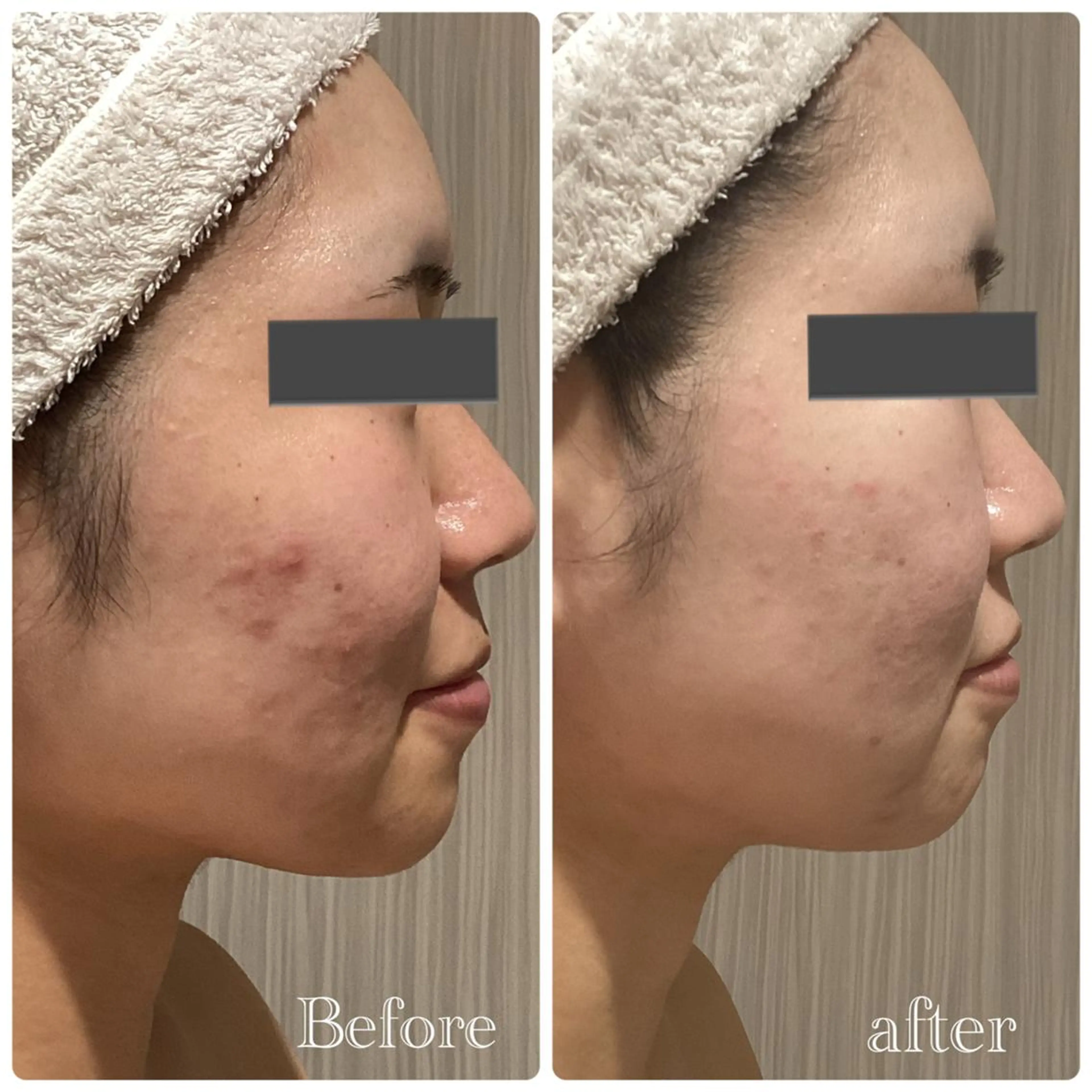 痩身脱毛専門店 Partirのエステ・リラクイメージ