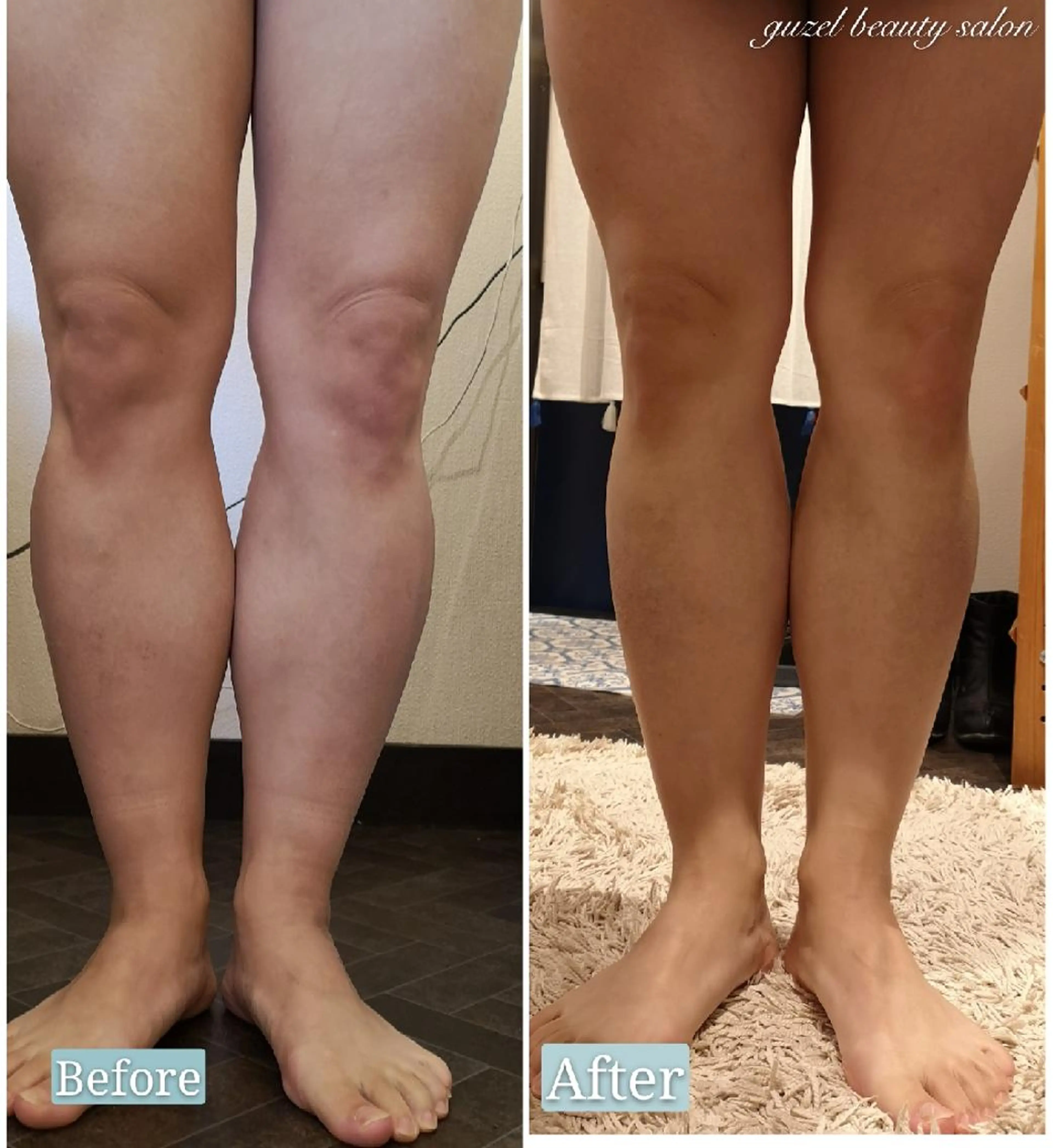 🅖🅤🅩🅔🅛 salonのエステ・リラクイメージ