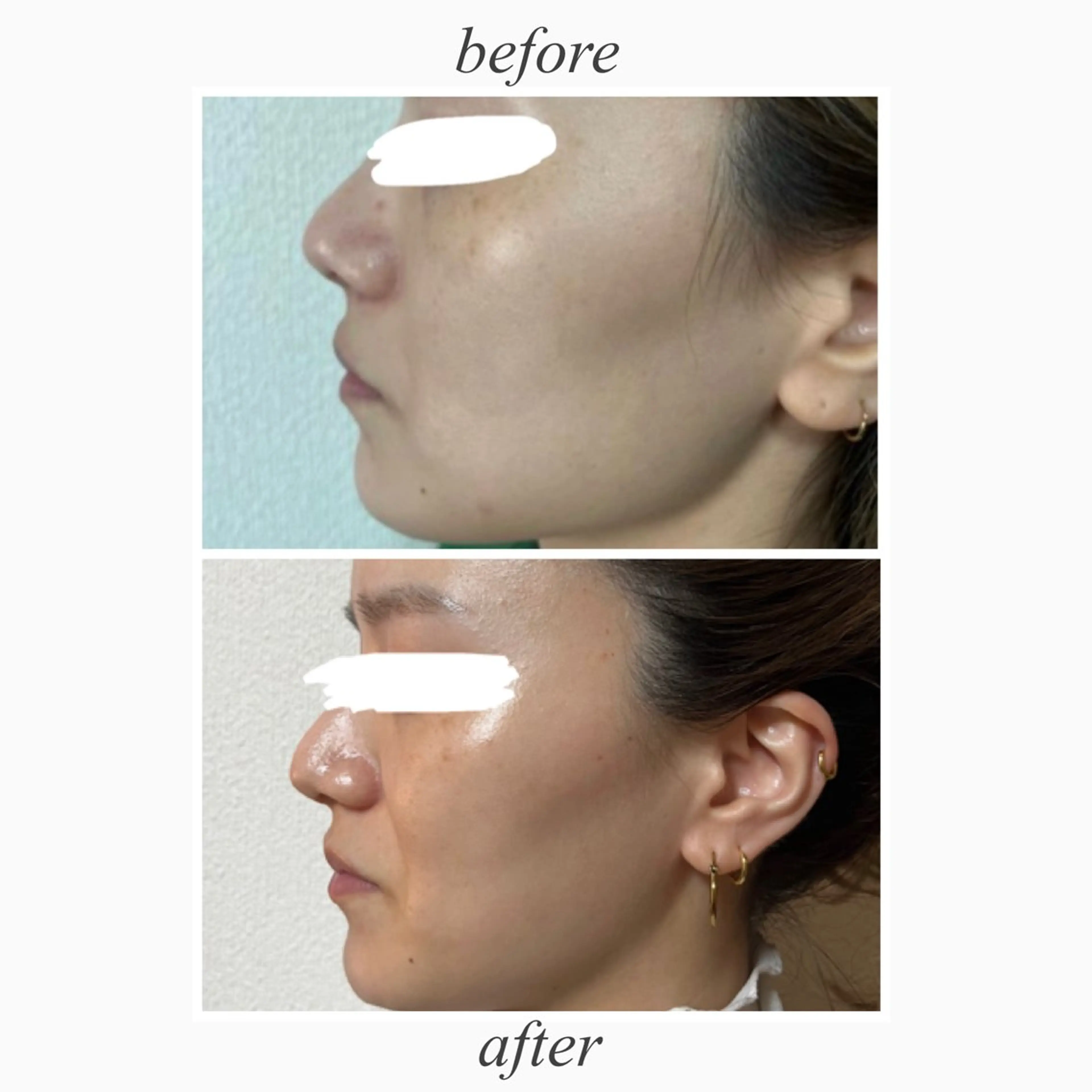 Aspility所属・Aspility /天文館のエステ・リラクイメージ