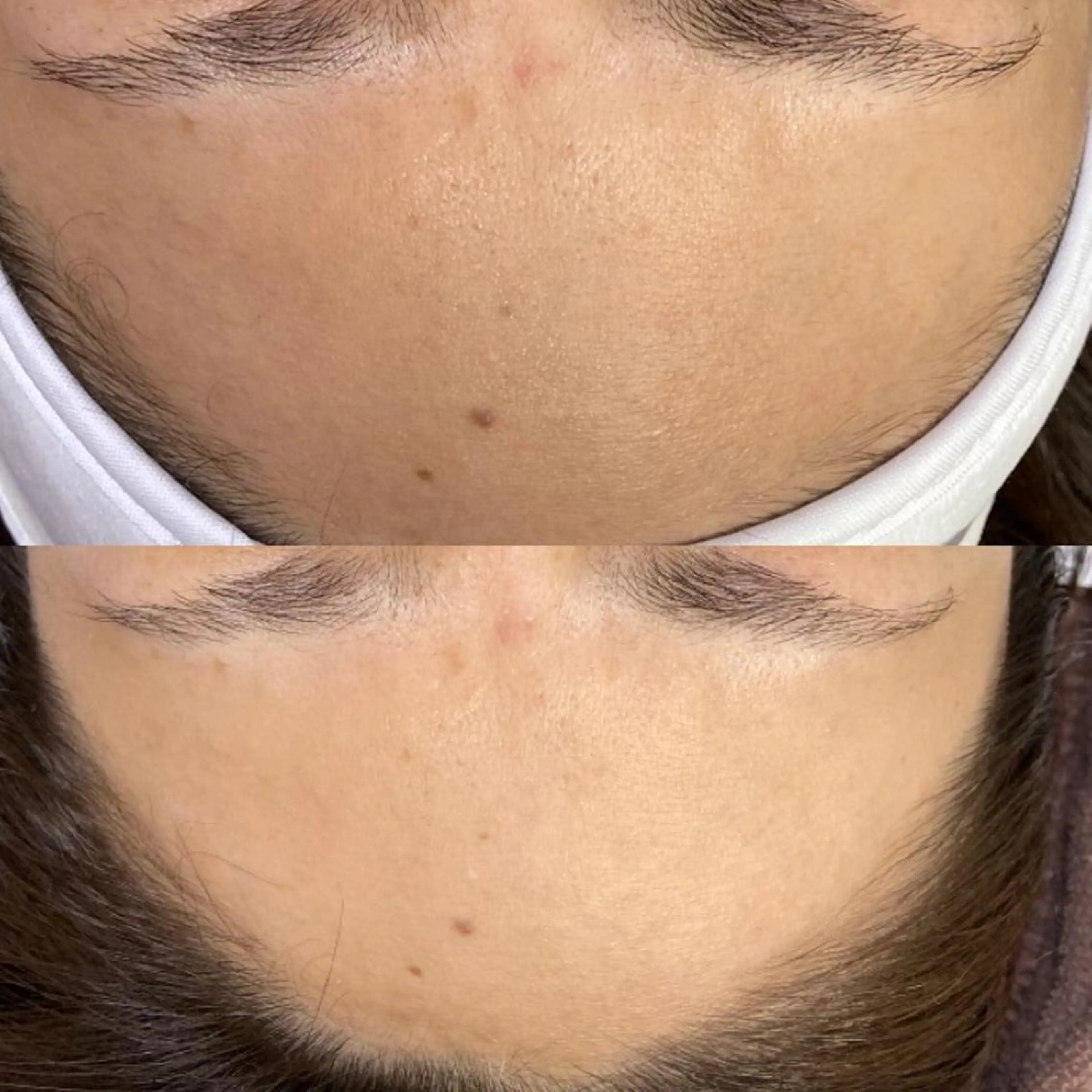 脱毛 産毛専門店 Bittoのエステ・リラクイメージ