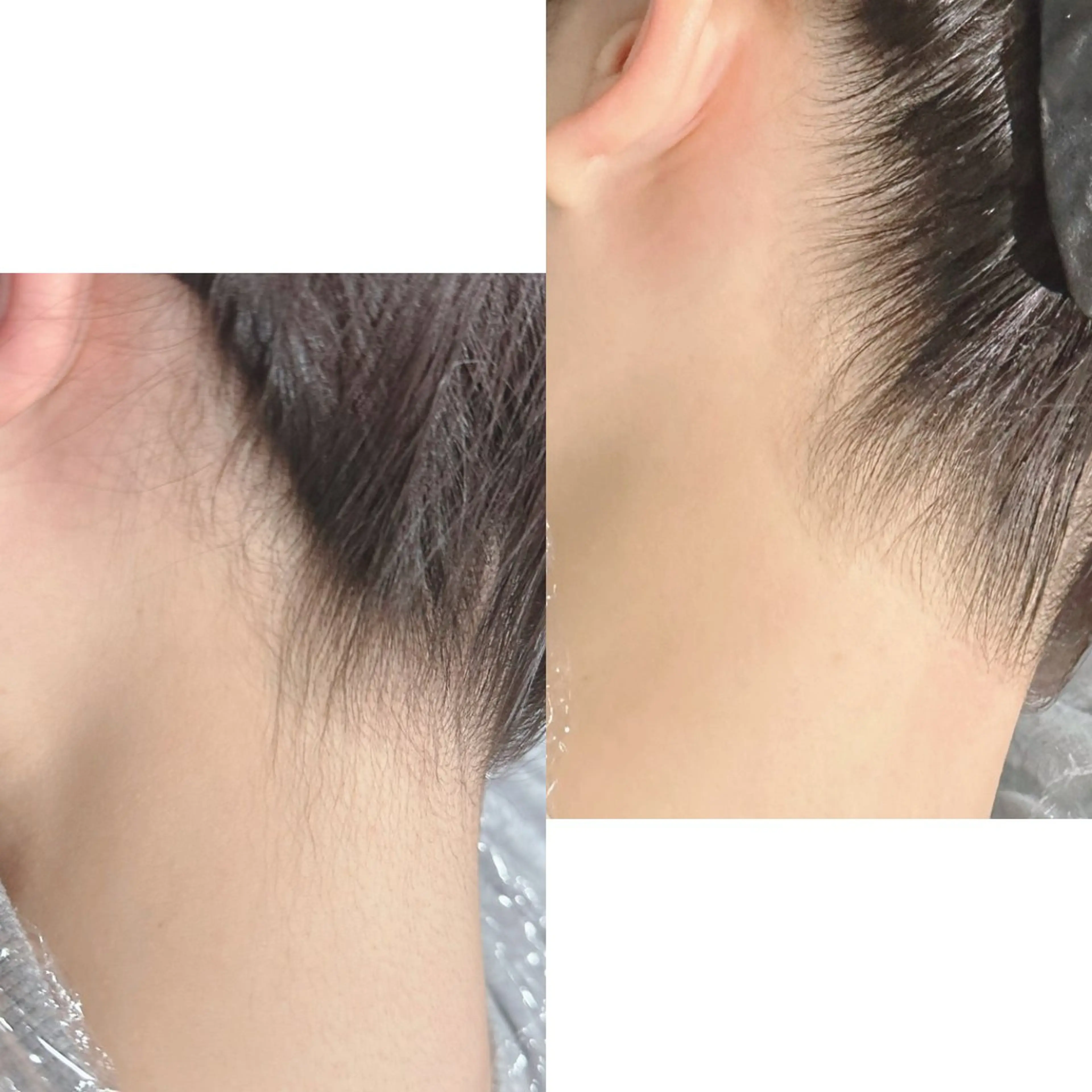 KOHOLA -ワックス脱毛専門-のエステ・リラクイメージ