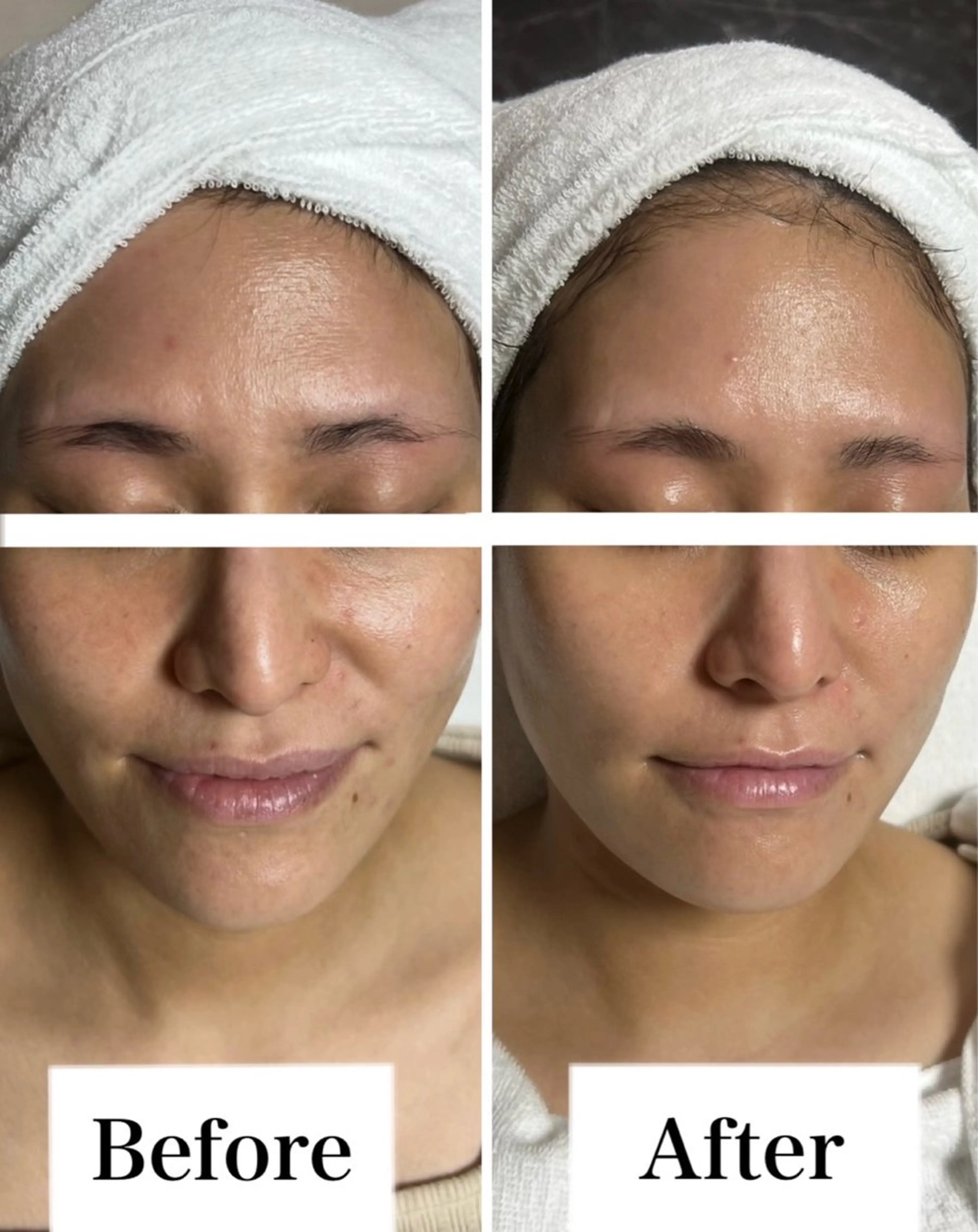 ROR所属・ROR Nanaのネイルデザイン