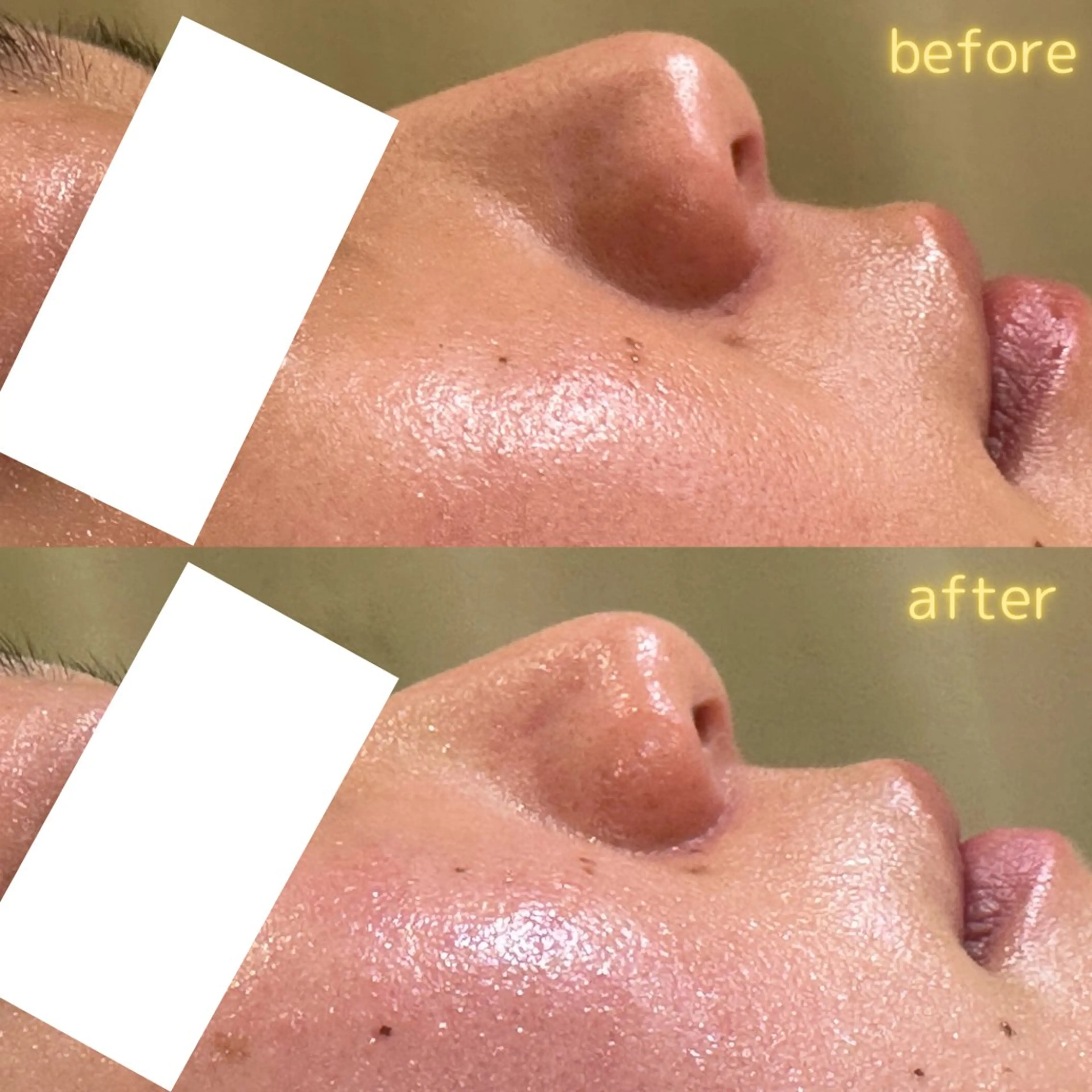 エステ pansy(パンジー)上野フェイシャルエステ専門店所属・pansy フェイシャルエステのエステ・リラクイメージ