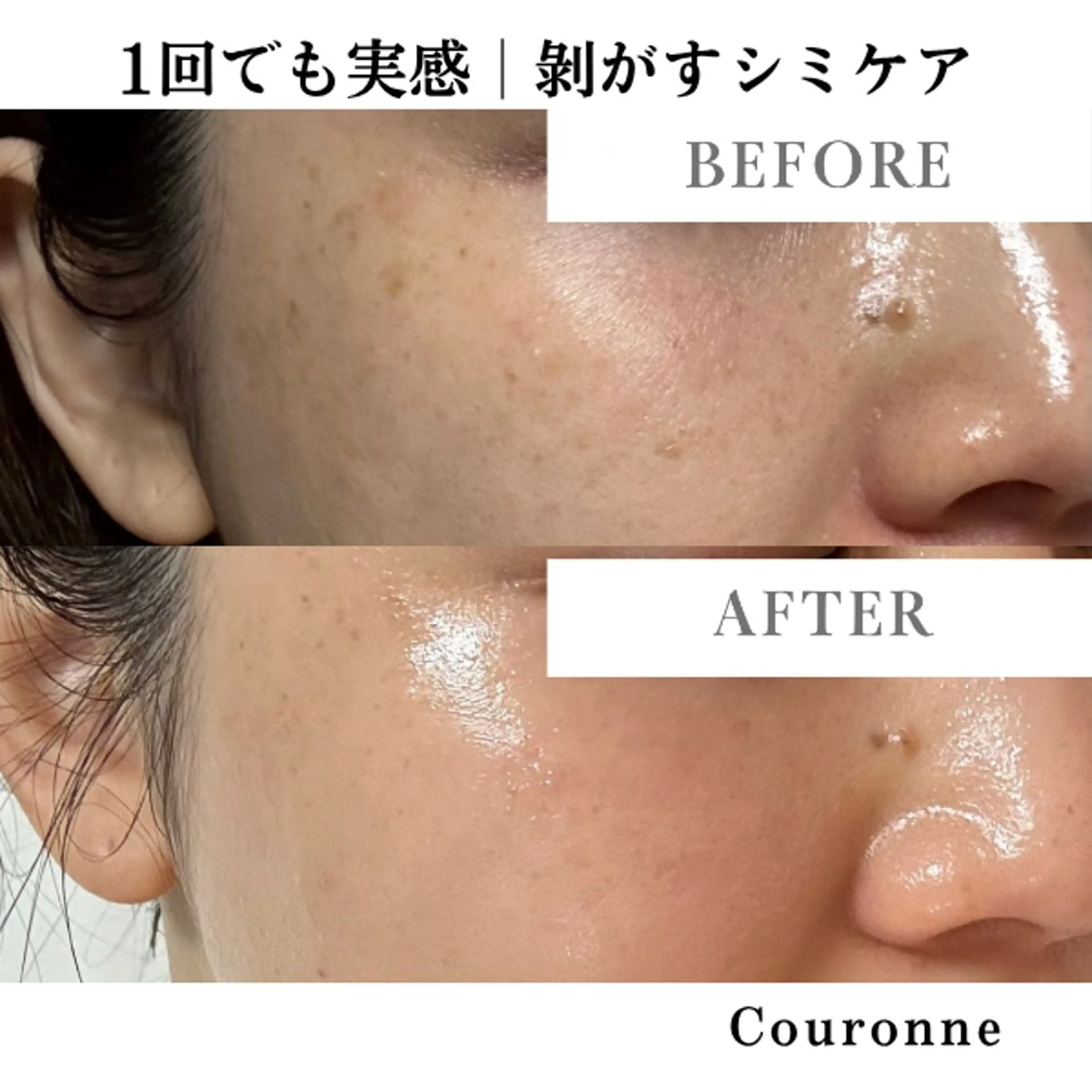 エステ シミ・毛穴ケア専門 クロヌYUKIのエステ・リラクイメージ