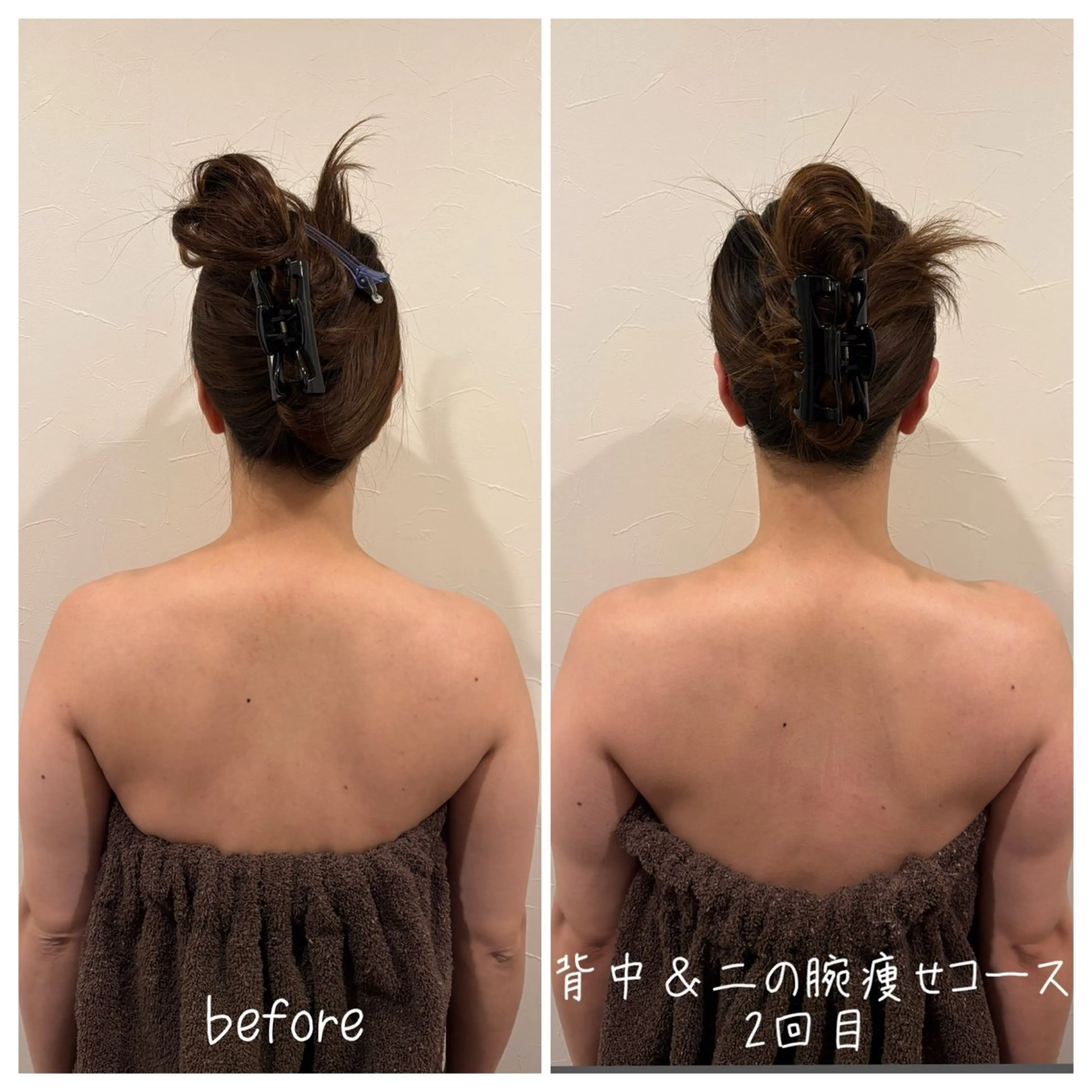 二の腕＆背中痩せ45分【5回コース】の写真