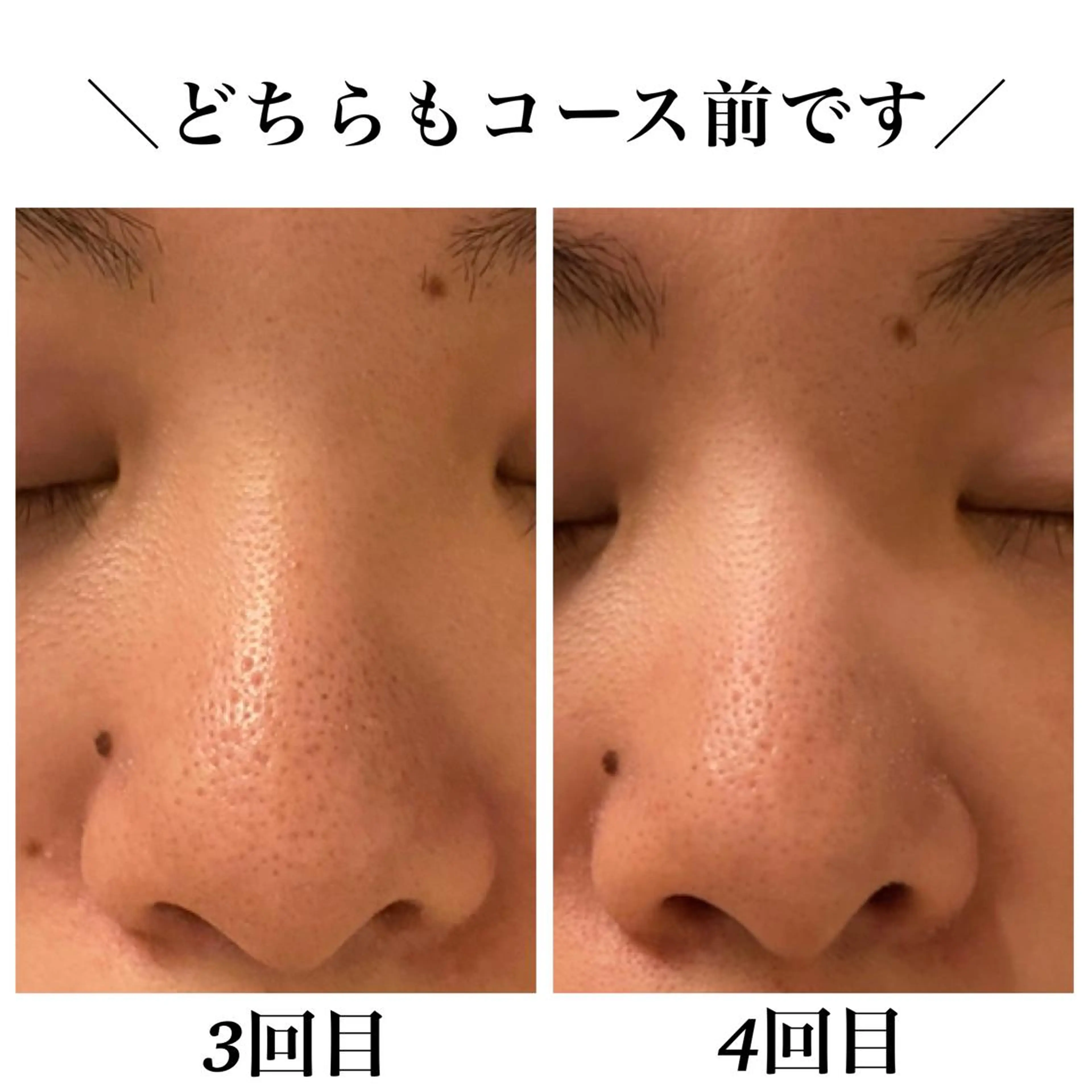 エステ リラク Bellesthe （ベルエステ）のエステ・リラクイメージ