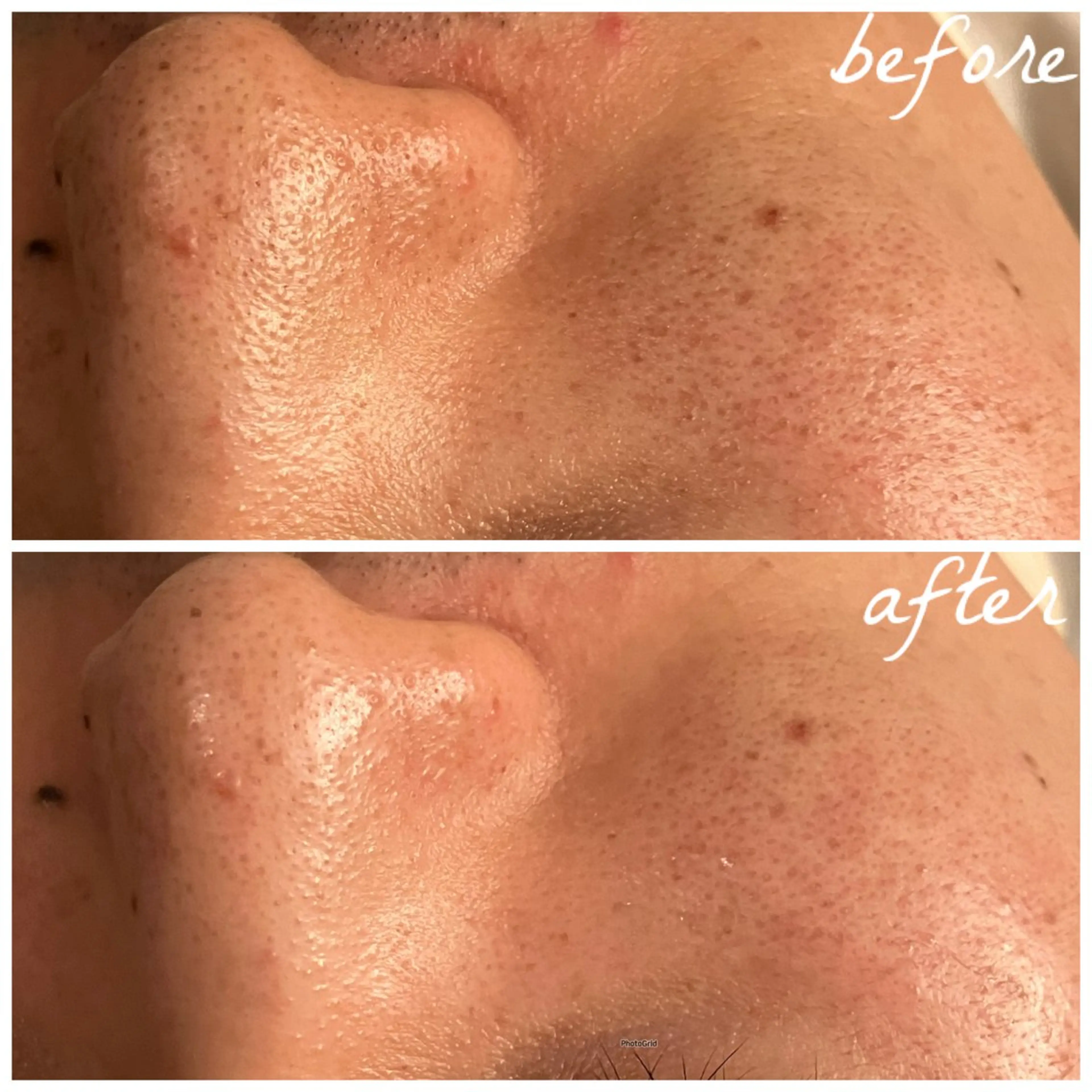 メンズ メナード岐阜茜部 杉浦のエステ・リラクイメージ