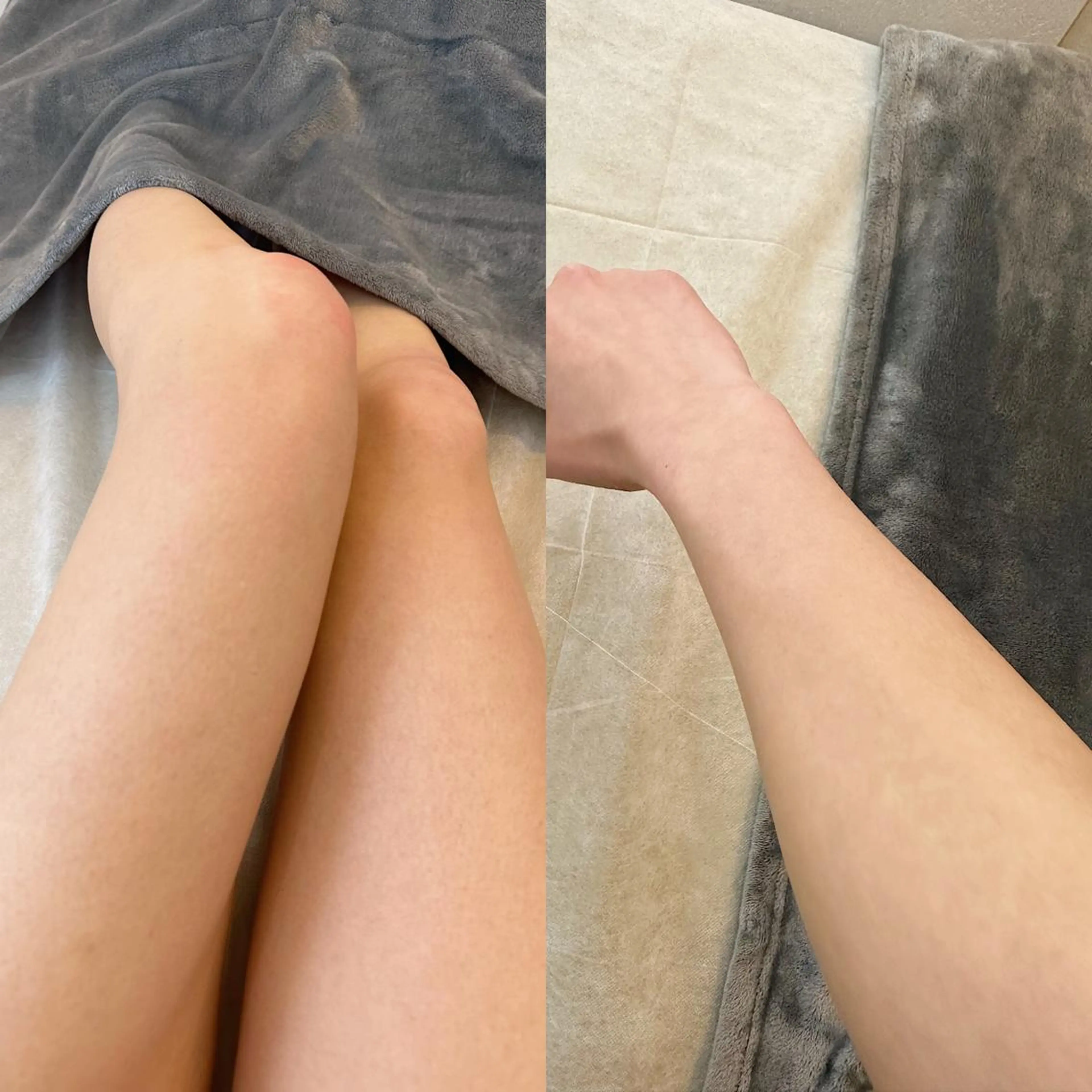 うなじ脱毛/美肌脱毛 LABELのエステ・リラクイメージ