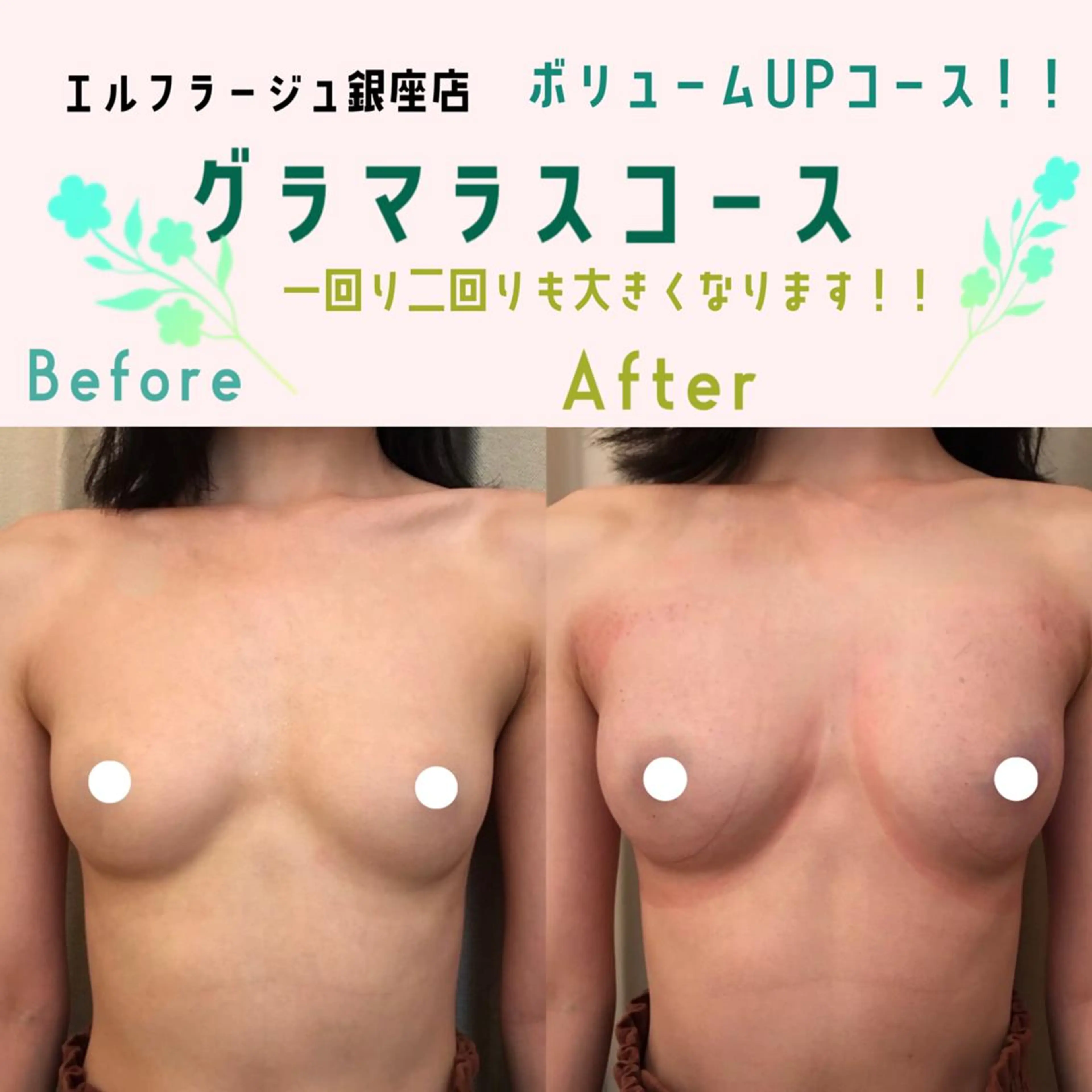 エルフラージュ 銀座店のエステ・リラクイメージ