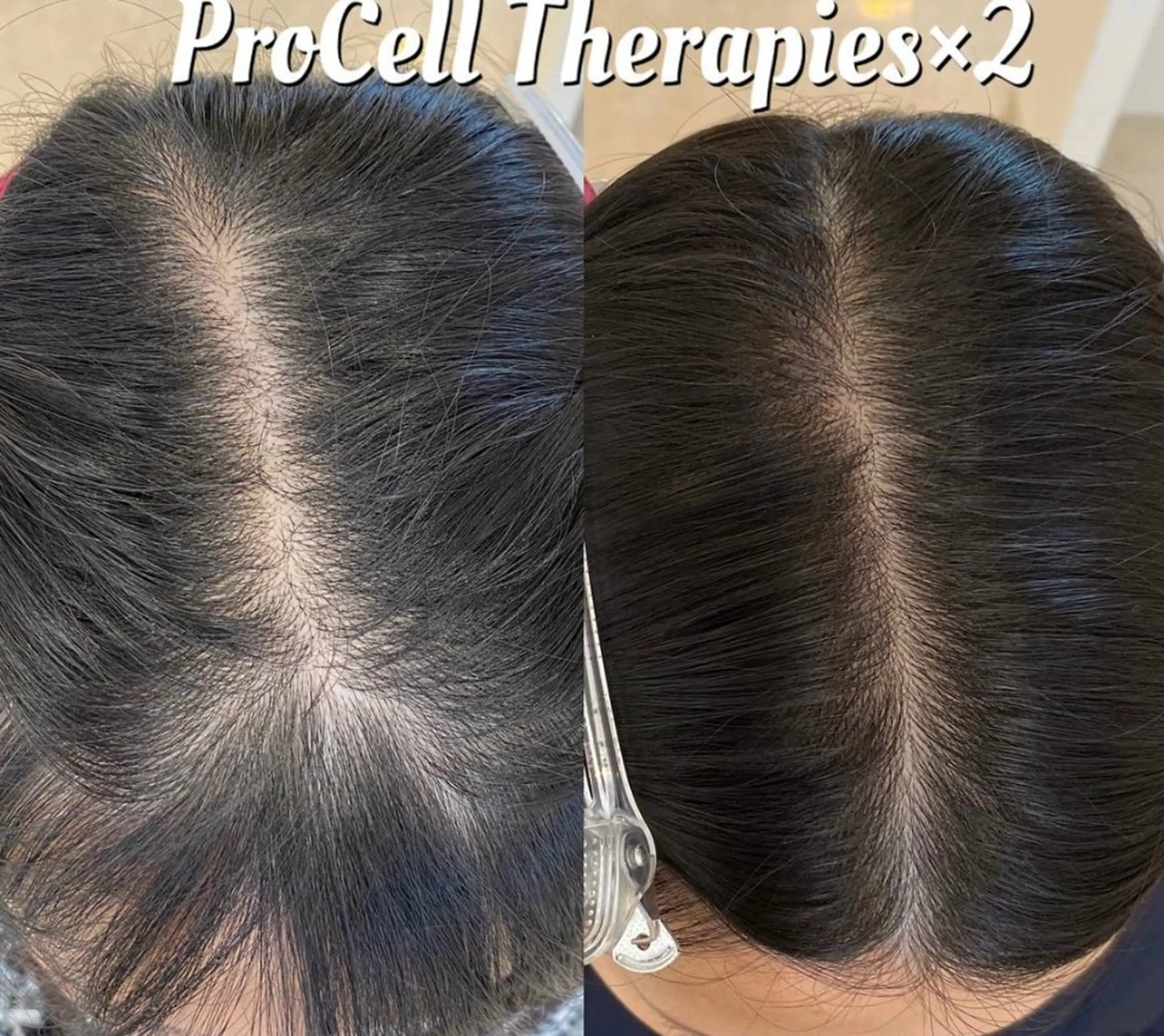 LOUISE. ／肌質・頭皮のエステ・リラクイメージ