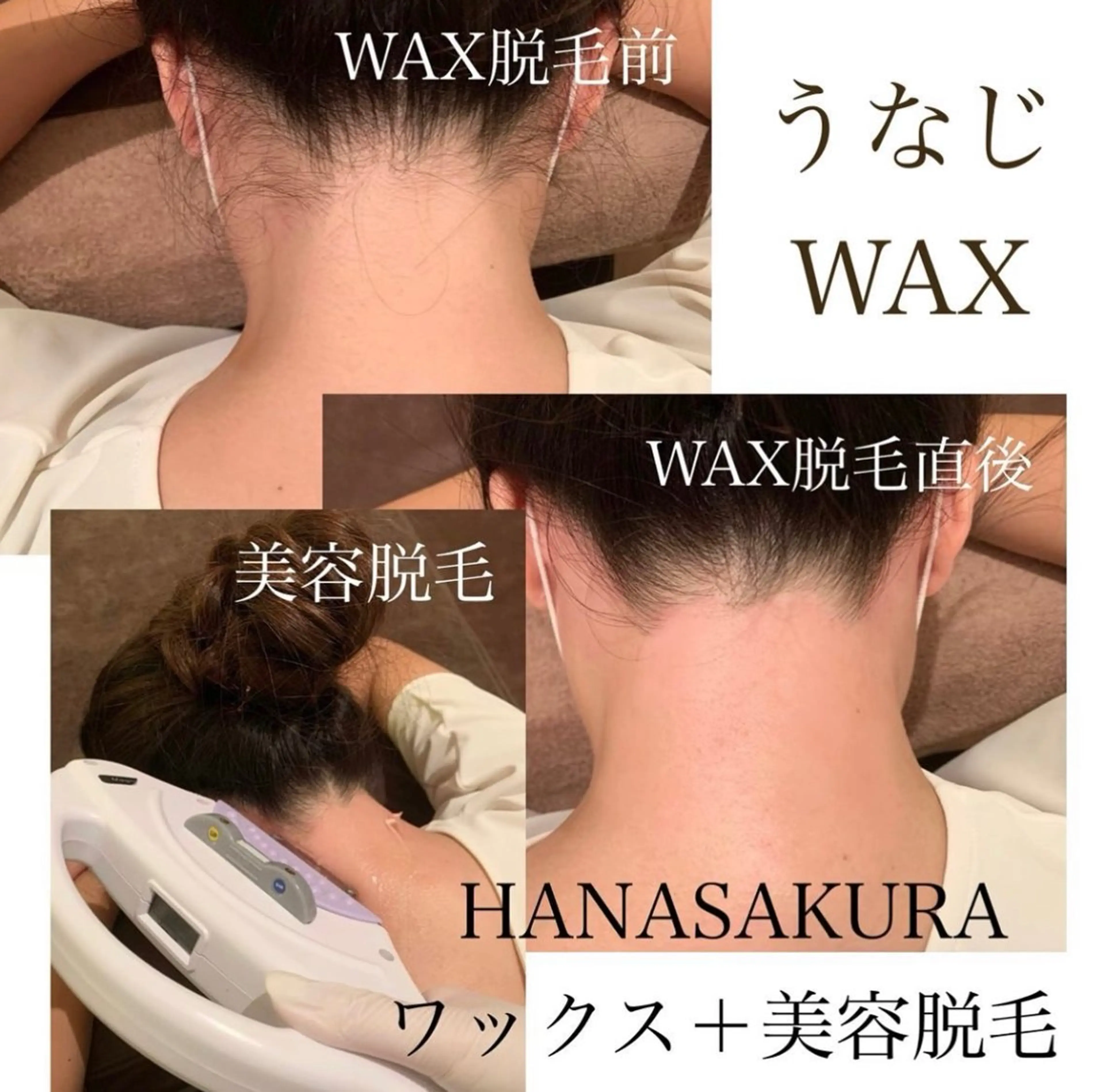 【仕上がり長持ち・減らしたい方】★うなじワックス脱毛+美容脱毛(要口コミ)の写真