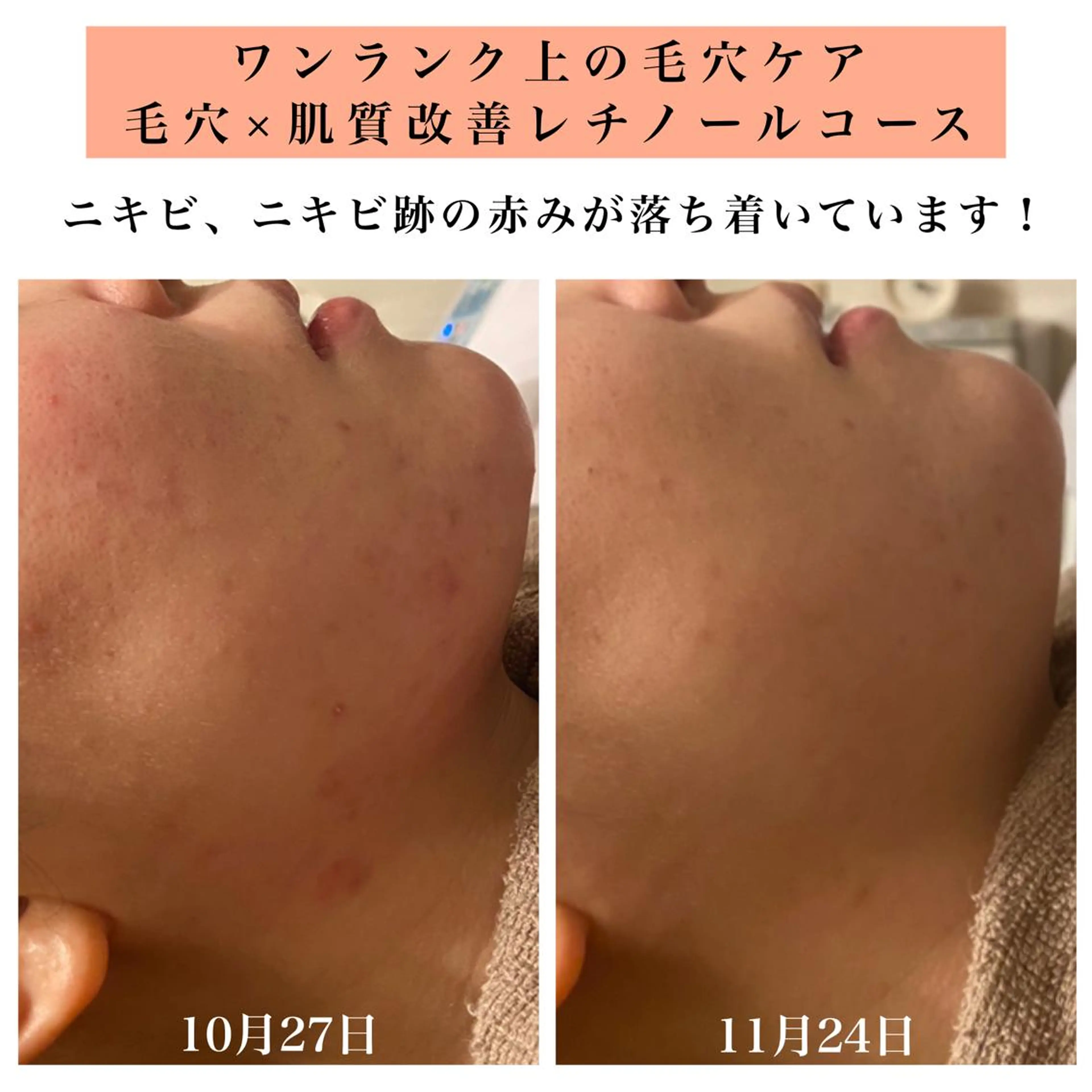 エステ リラク Bellesthe (ベルエステ)のエステ・リラクイメージ