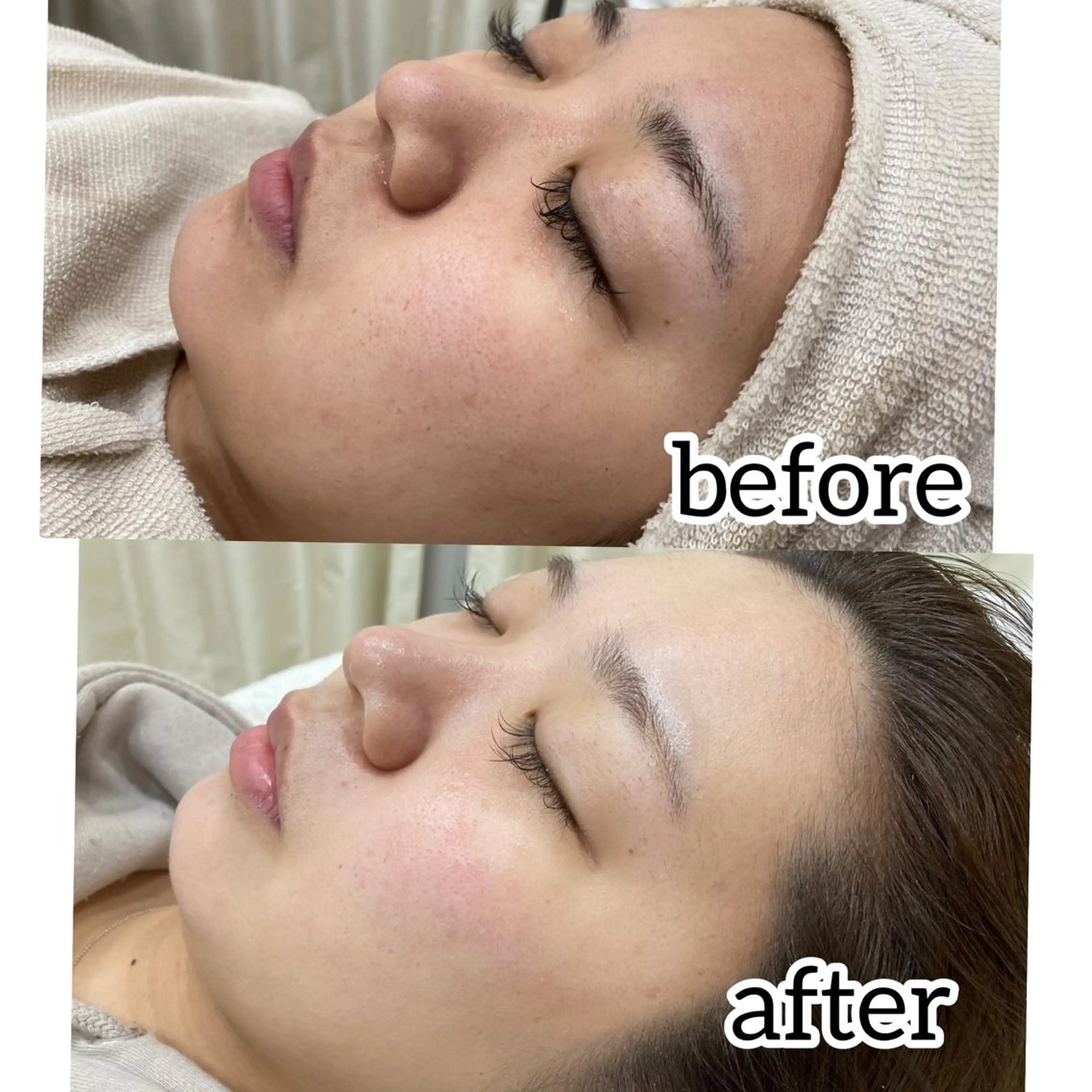 エステ laluna saki...のその他イメージ