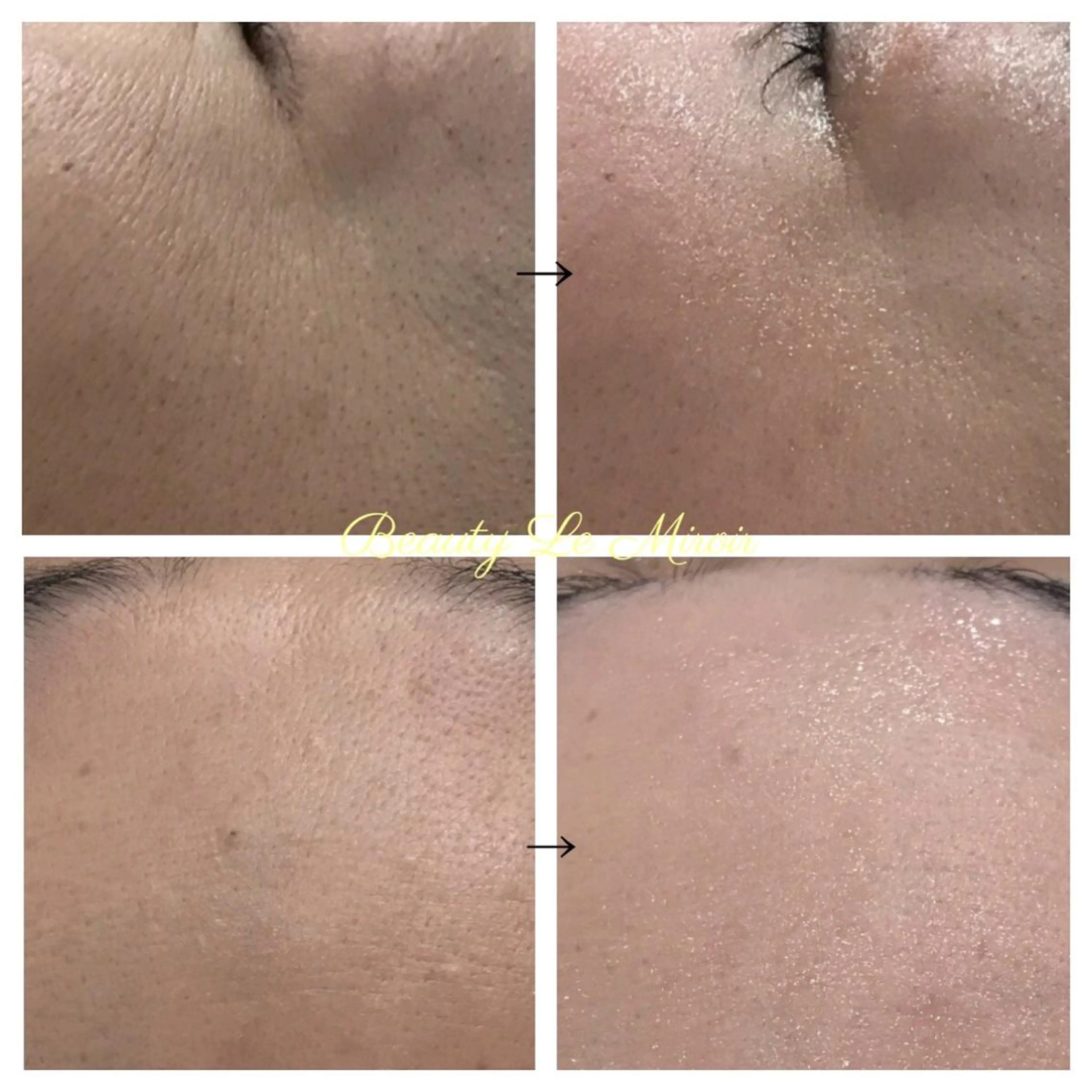 ビューティー ミロワールのエステ・リラクイメージ