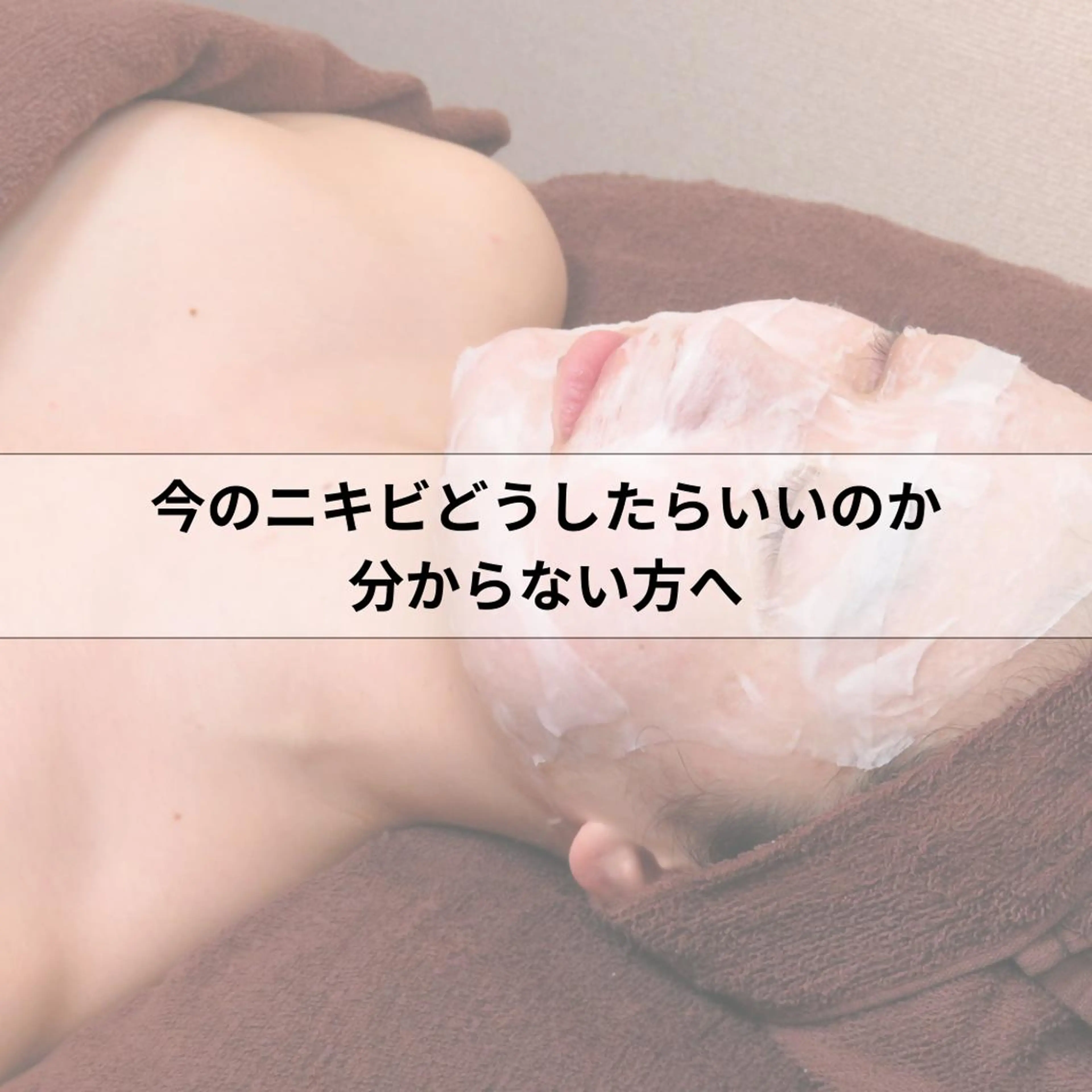 【人気No.1メニュー🥇】ダウンタイムなし | 炎上中もOKニキビ・赤み鎮静フェイシャルの写真