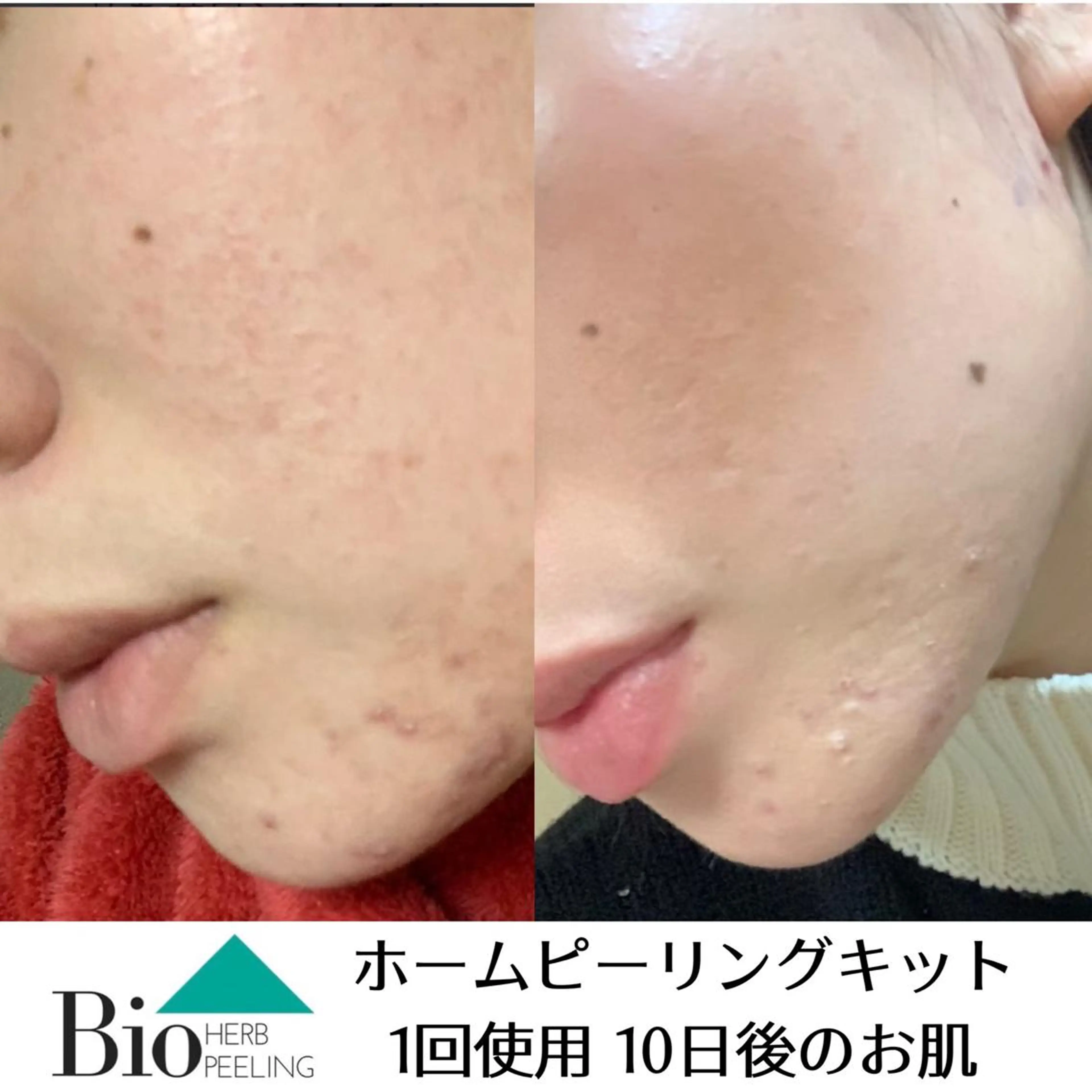 SALON BioBioのエステ・リラクイメージ