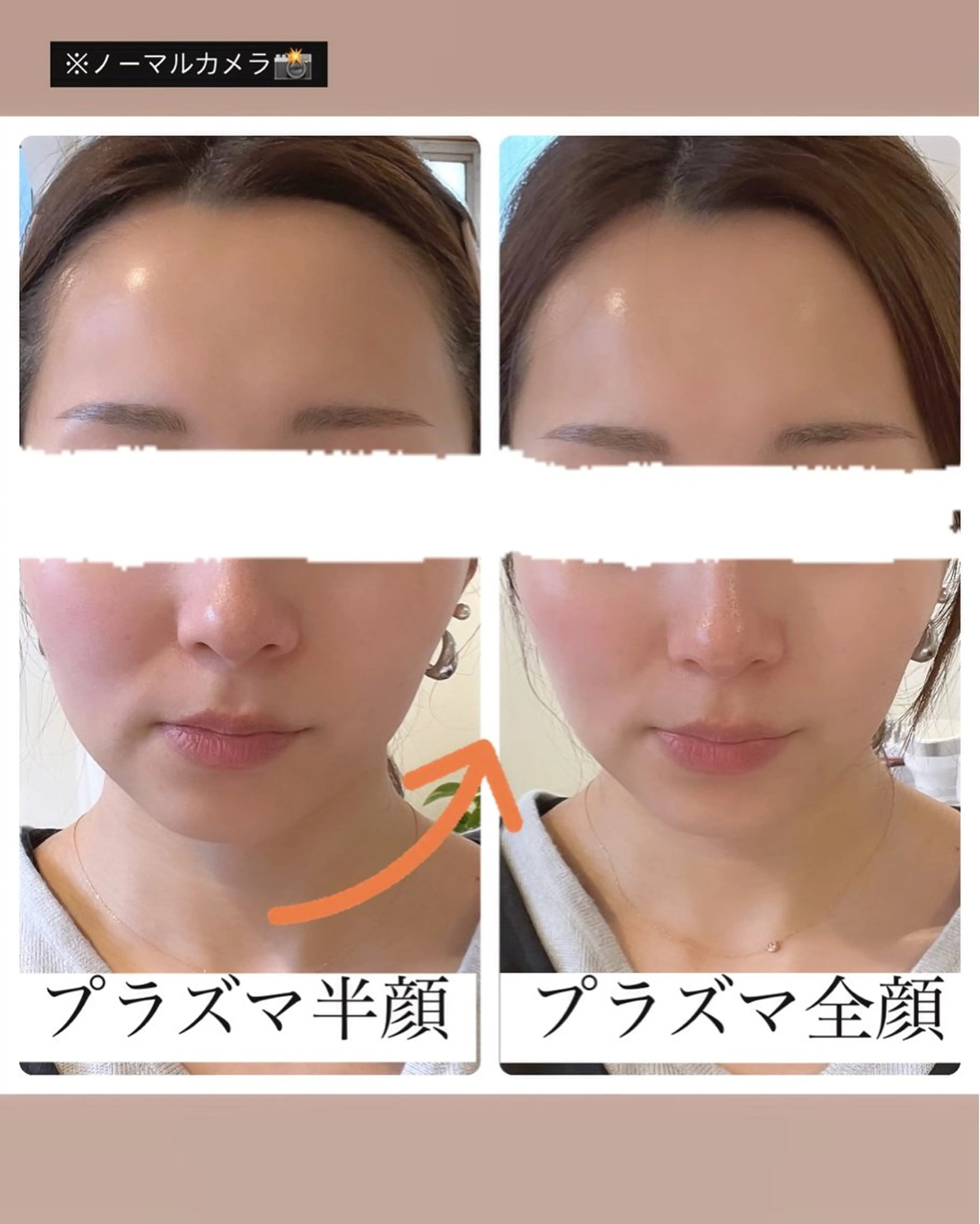 肌質改善Mbelle 越谷レイクタウン🌿のエステ・リラクイメージ