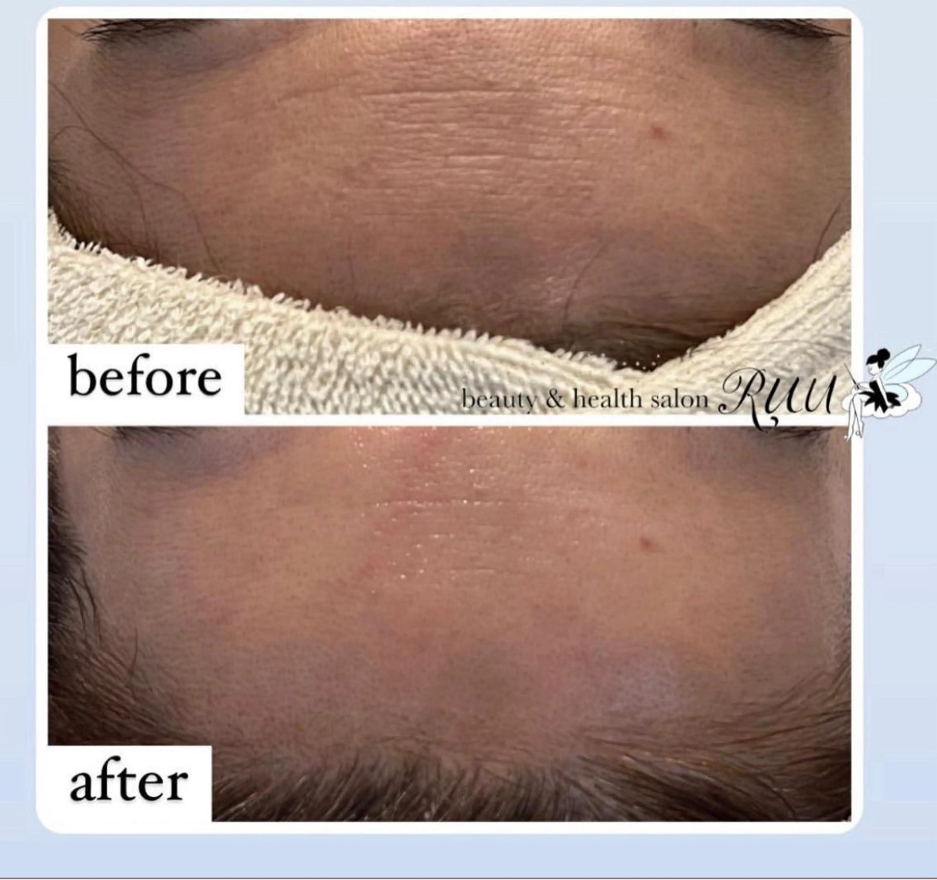 【頭痛、睡眠改善】 salon RUUのエステ・リラクイメージ