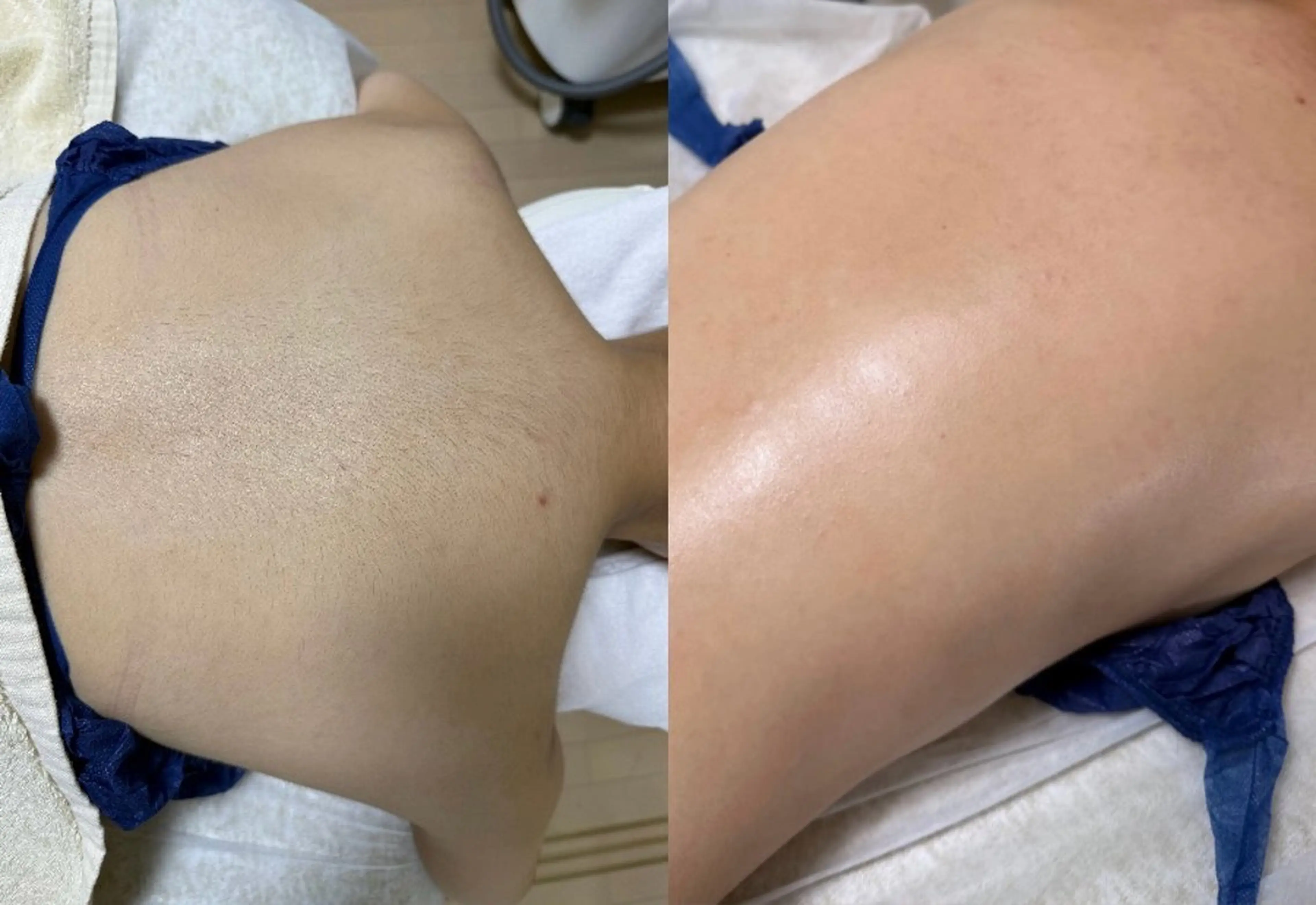 脱毛 エステサロン Mi-mi.iのエステ・リラクイメージ