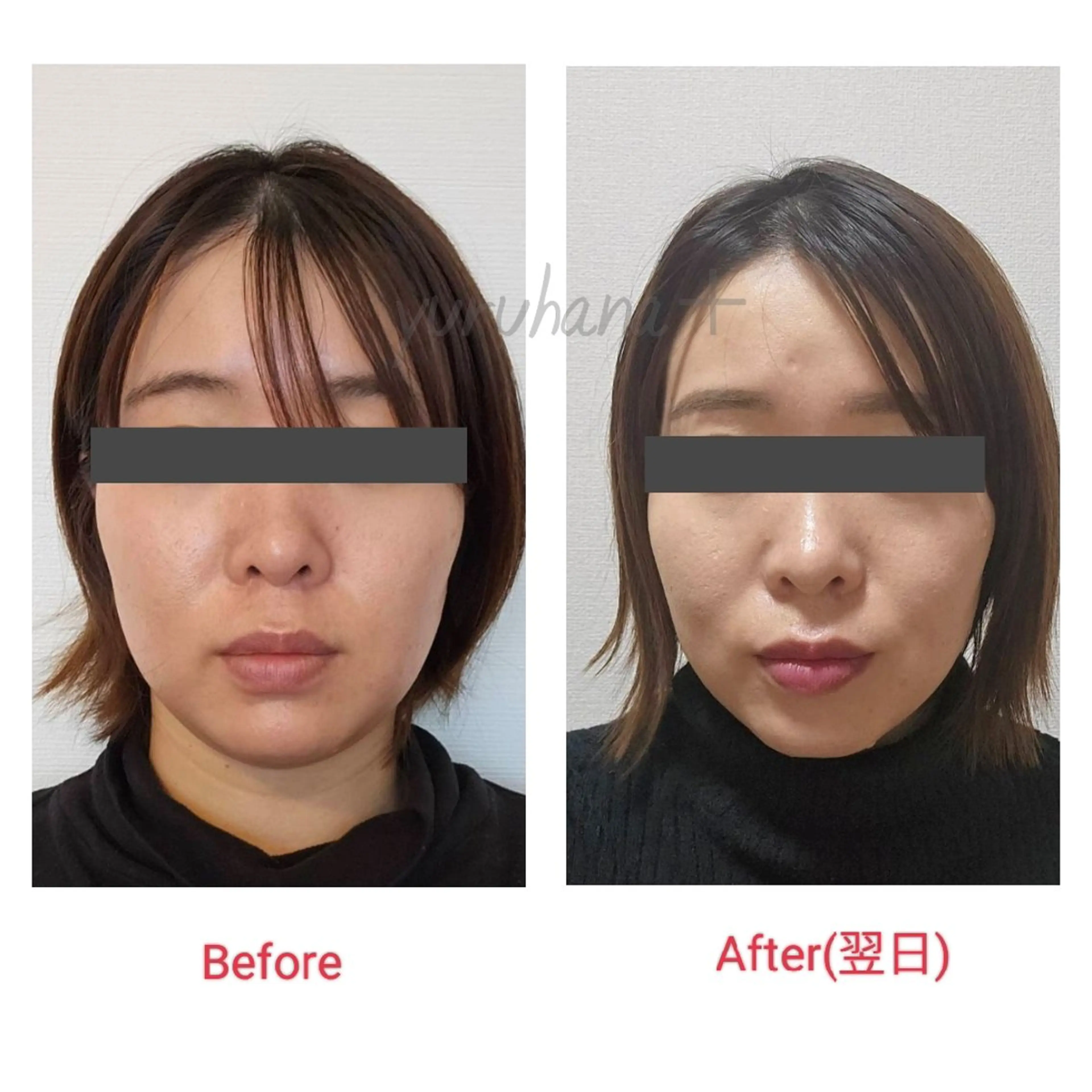 小顔矯正&足つぼサロン　yuruhana所属・小顔矯正&足つぼ yuruhanaのエステ・リラクイメージ