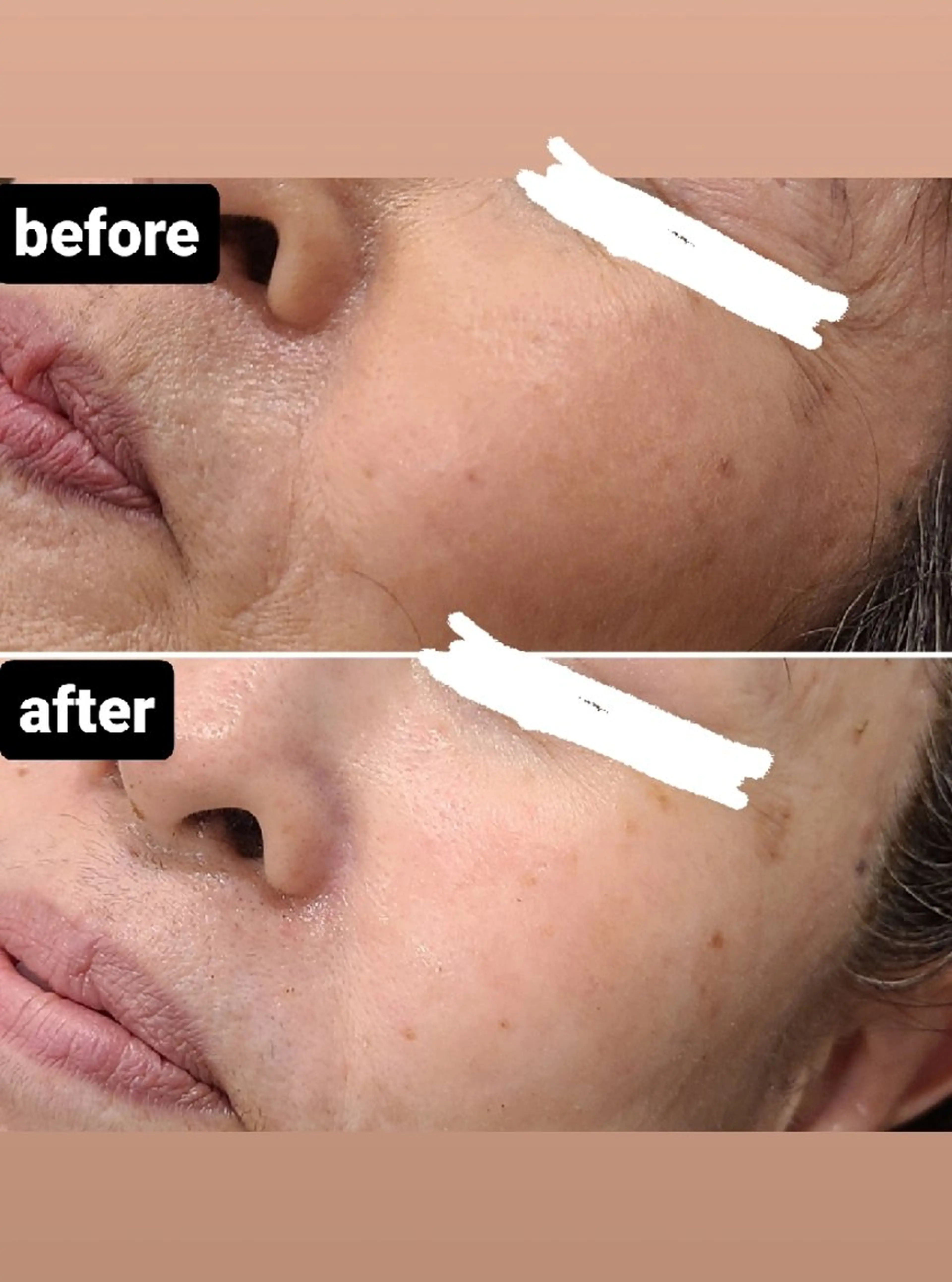 BEAUTYSARON　SiS.所属・高橋 沙奈江のエステ・リラクイメージ