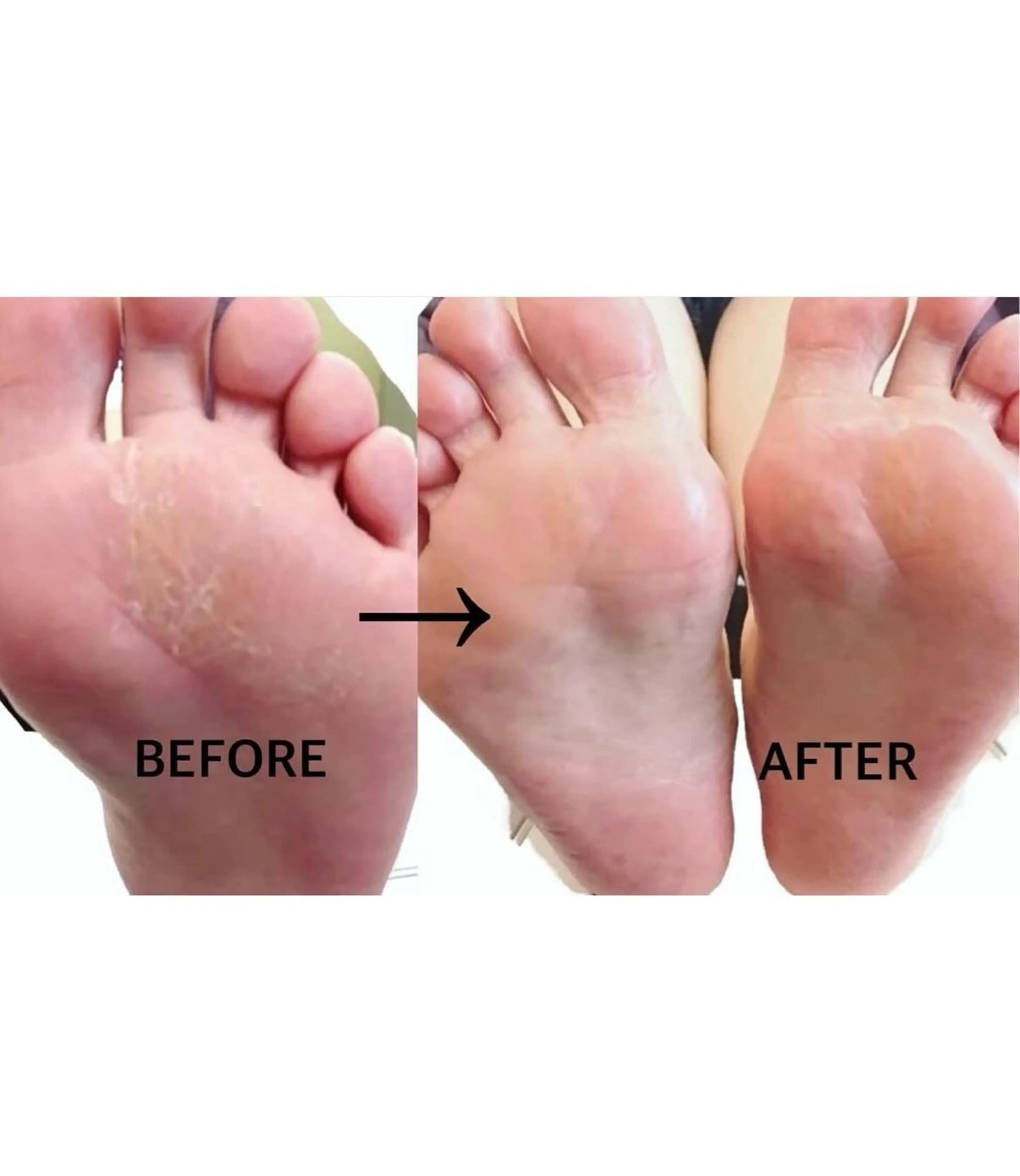 ネイル フットネイル ______ TKM  NAILのネイルデザイン