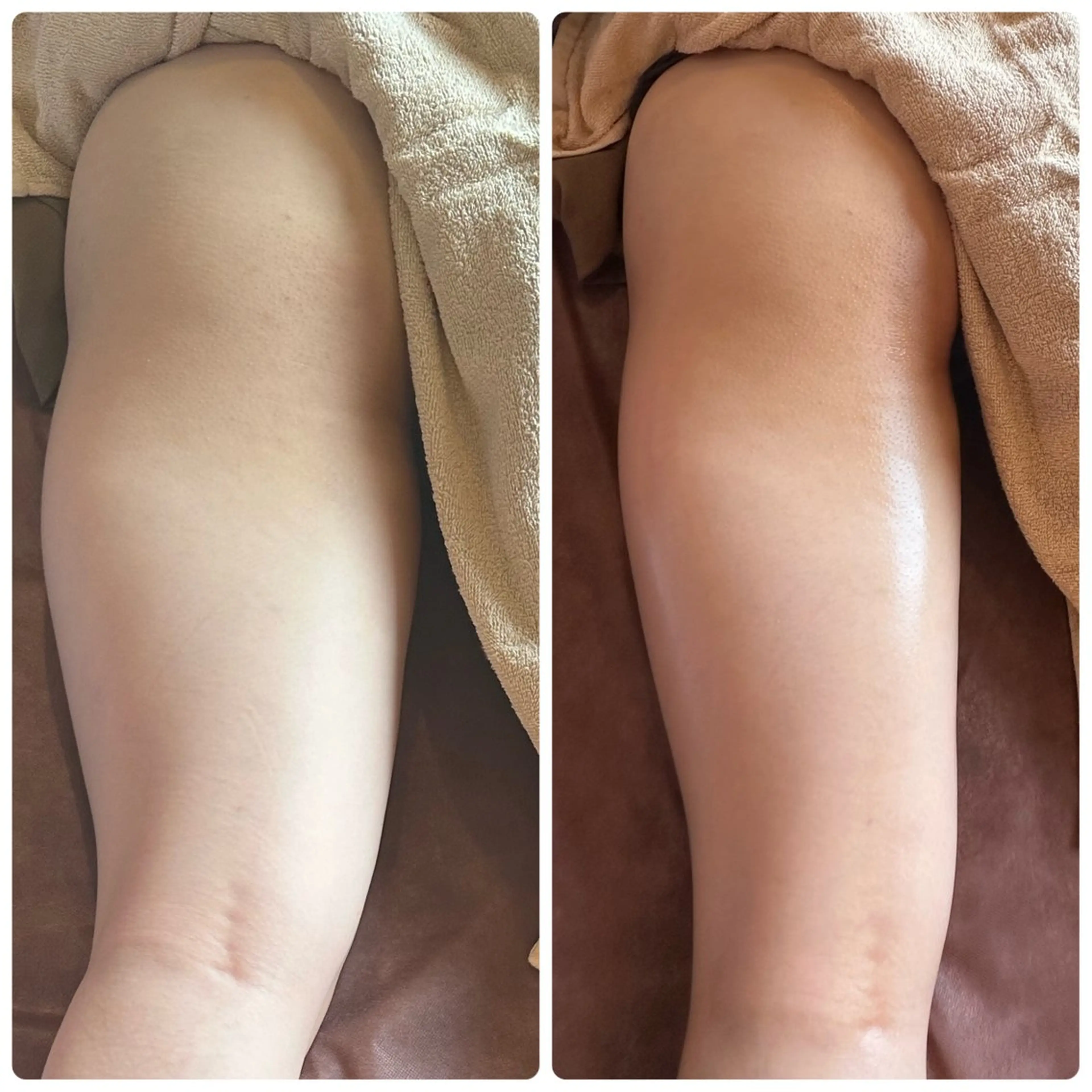 ハイフ・小顔・骨盤 シャングリラのエステ・リラクイメージ