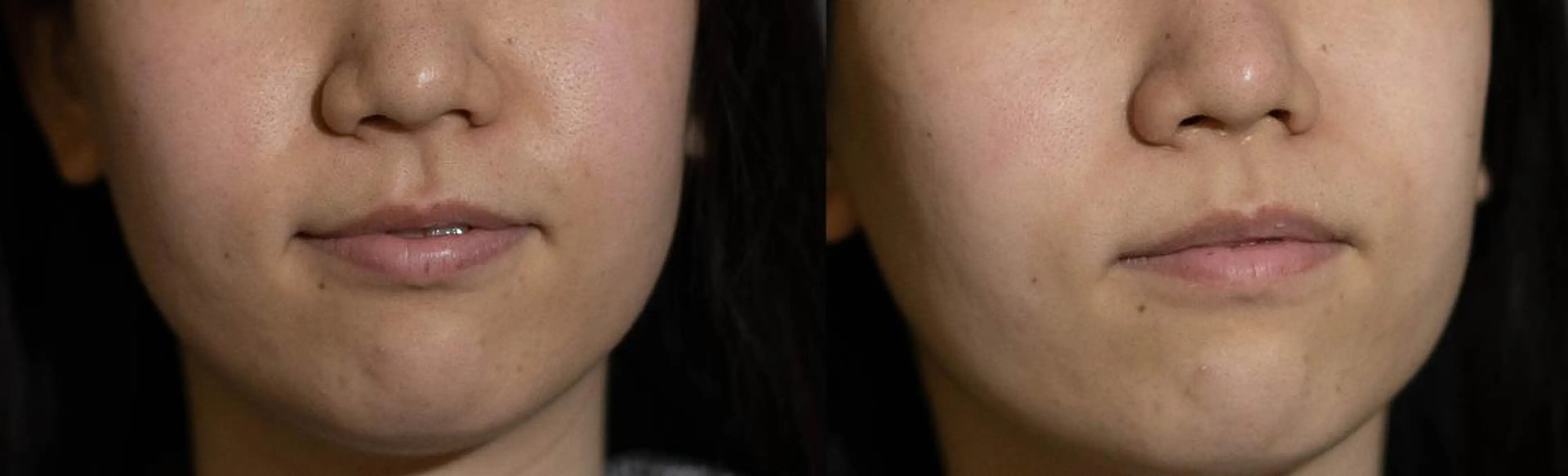 中山 秀展のエステ・リラクイメージ