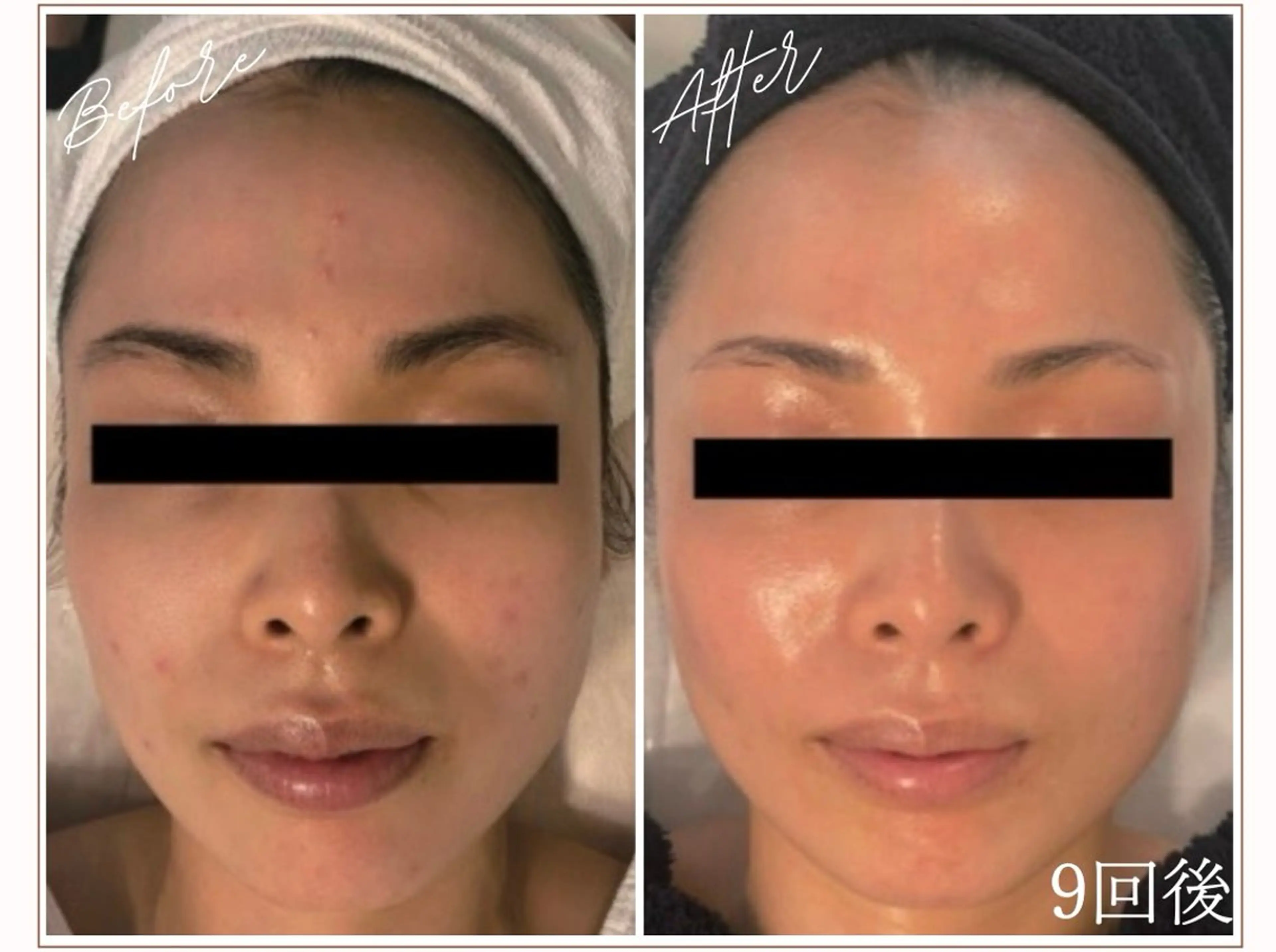 MYubelle ミューベルのエステ・リラクイメージ