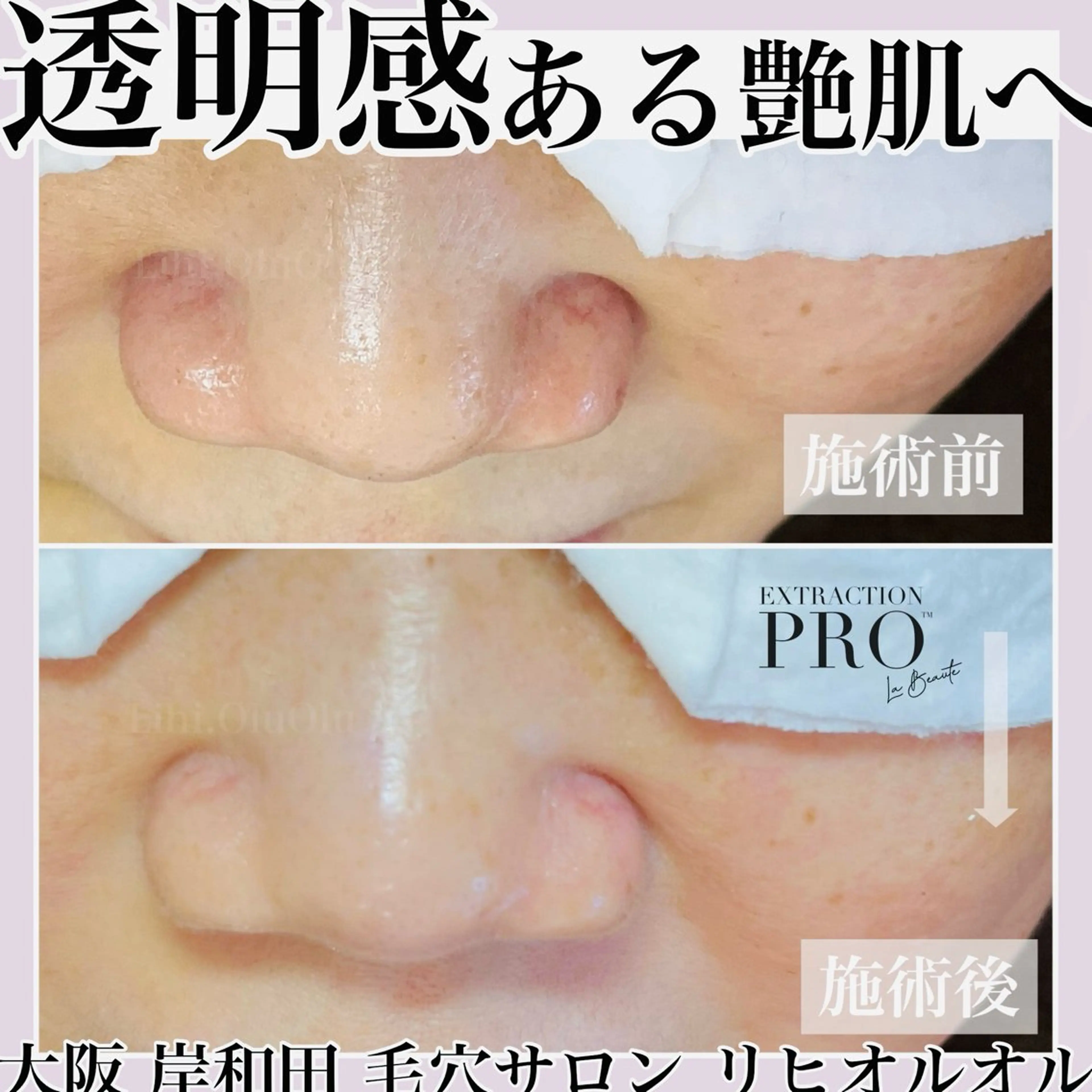 毛穴汚れ改善専門店/ 岸和田/リヒオルオルのエステ・リラクイメージ