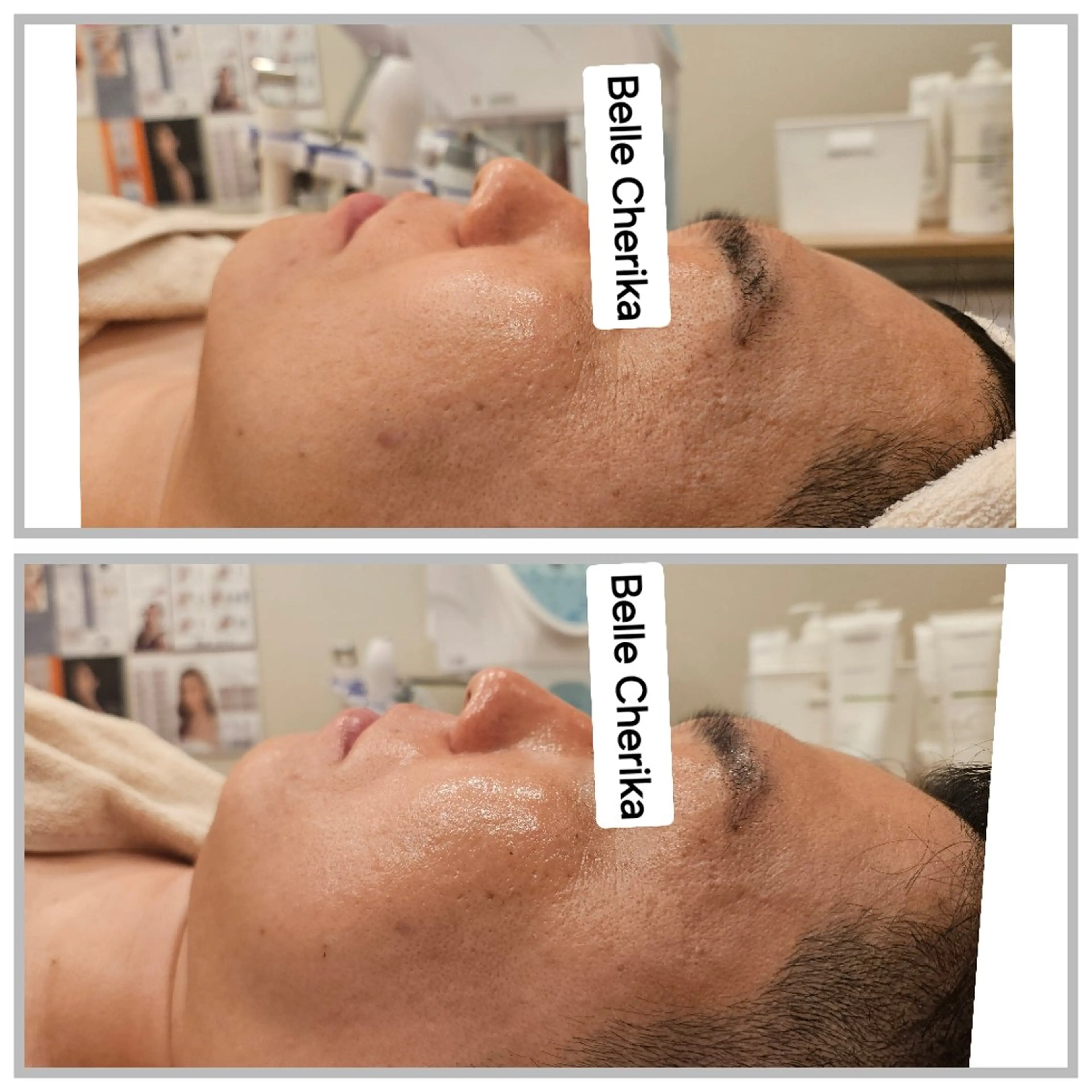 エステ ベル チェリカ 三城のエステ・リラクイメージ