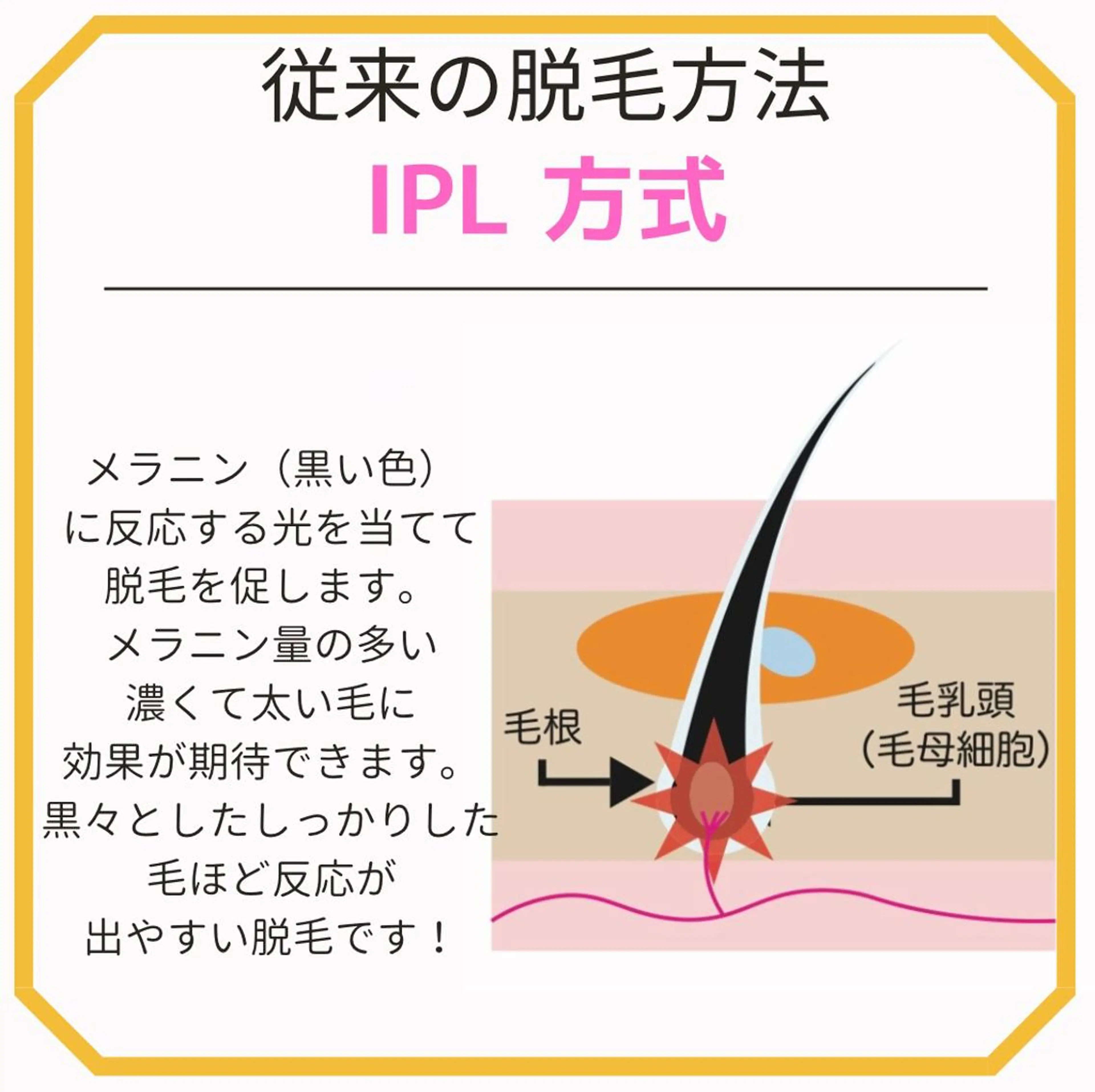 メンズ キッズ STELLAR. 谷岡恵里香のエステ・リラクイメージ