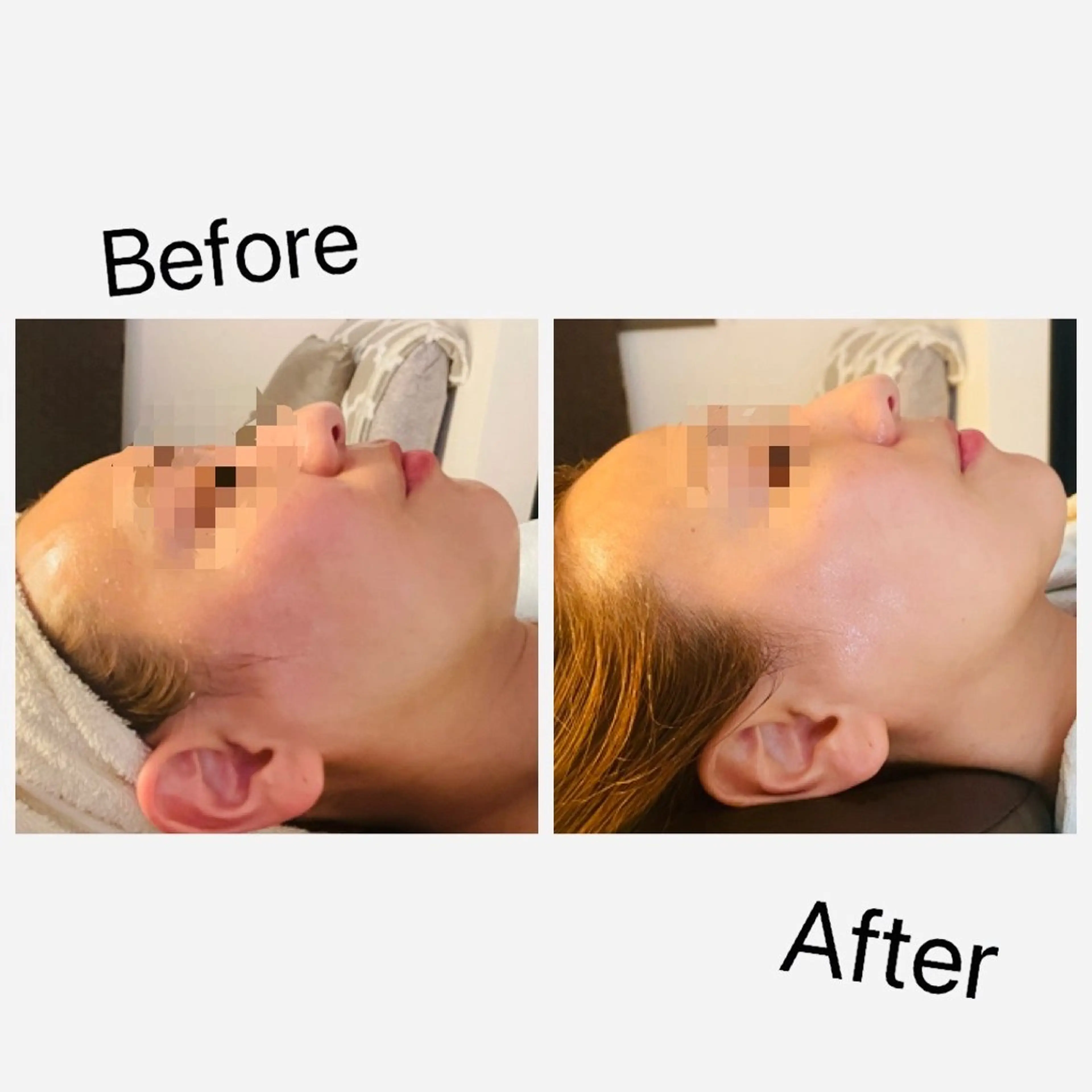 LEMONADE レモネードのエステ・リラクイメージ