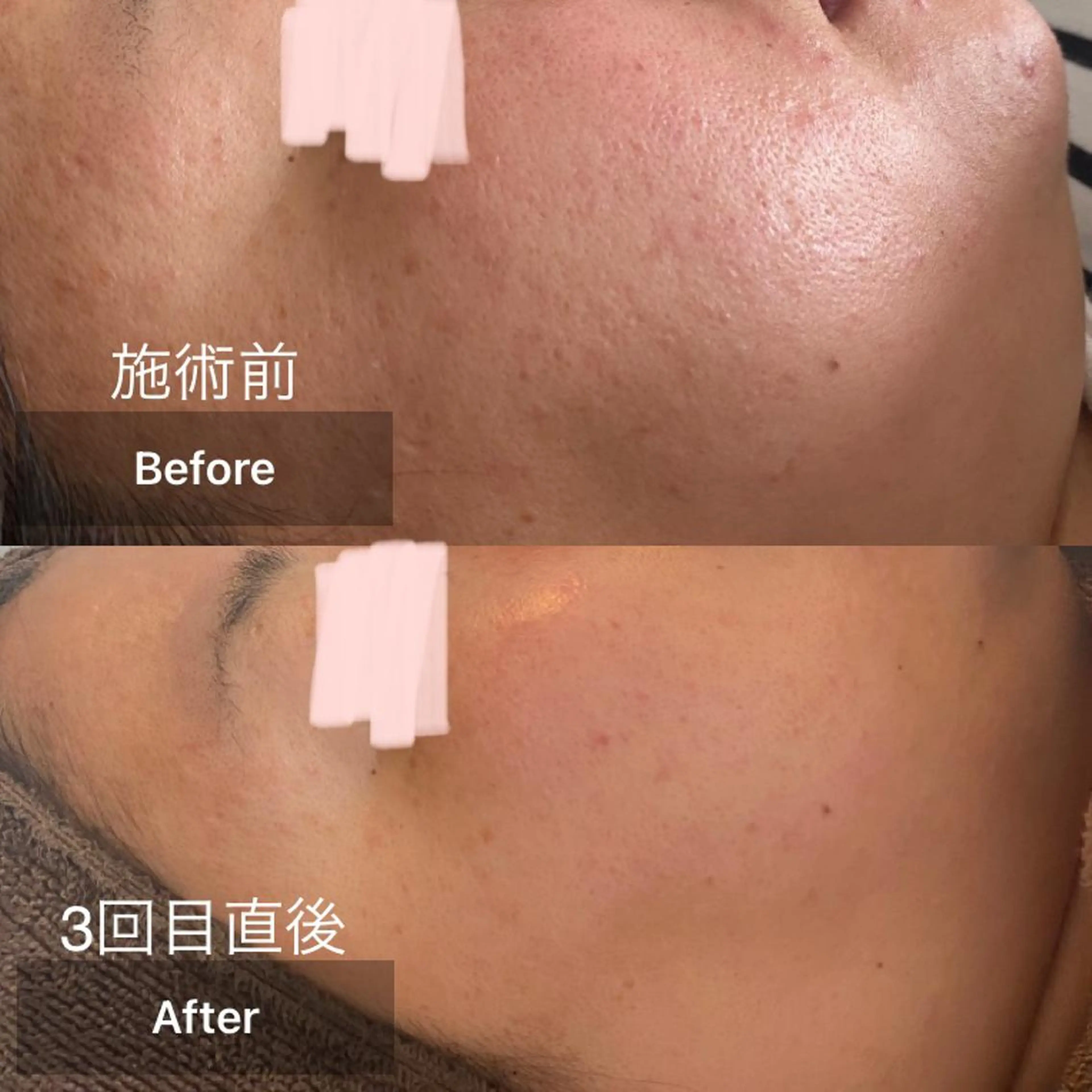 メンズ キッズ エステ 美肌と癒しのサロン Lu,Mieのエステ・リラクイメージ