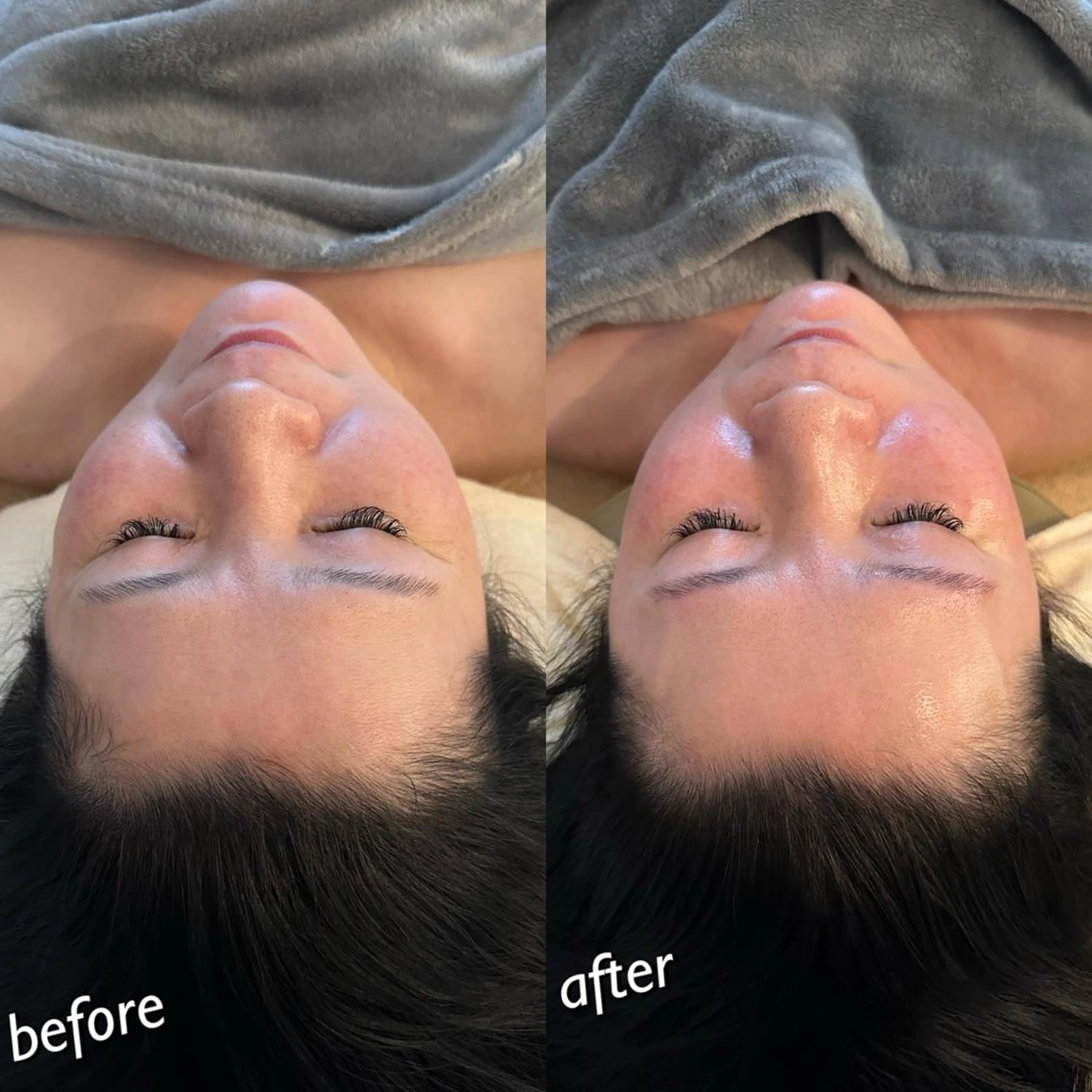 うなじ脱毛/美肌脱毛 LABELのエステ・リラクイメージ