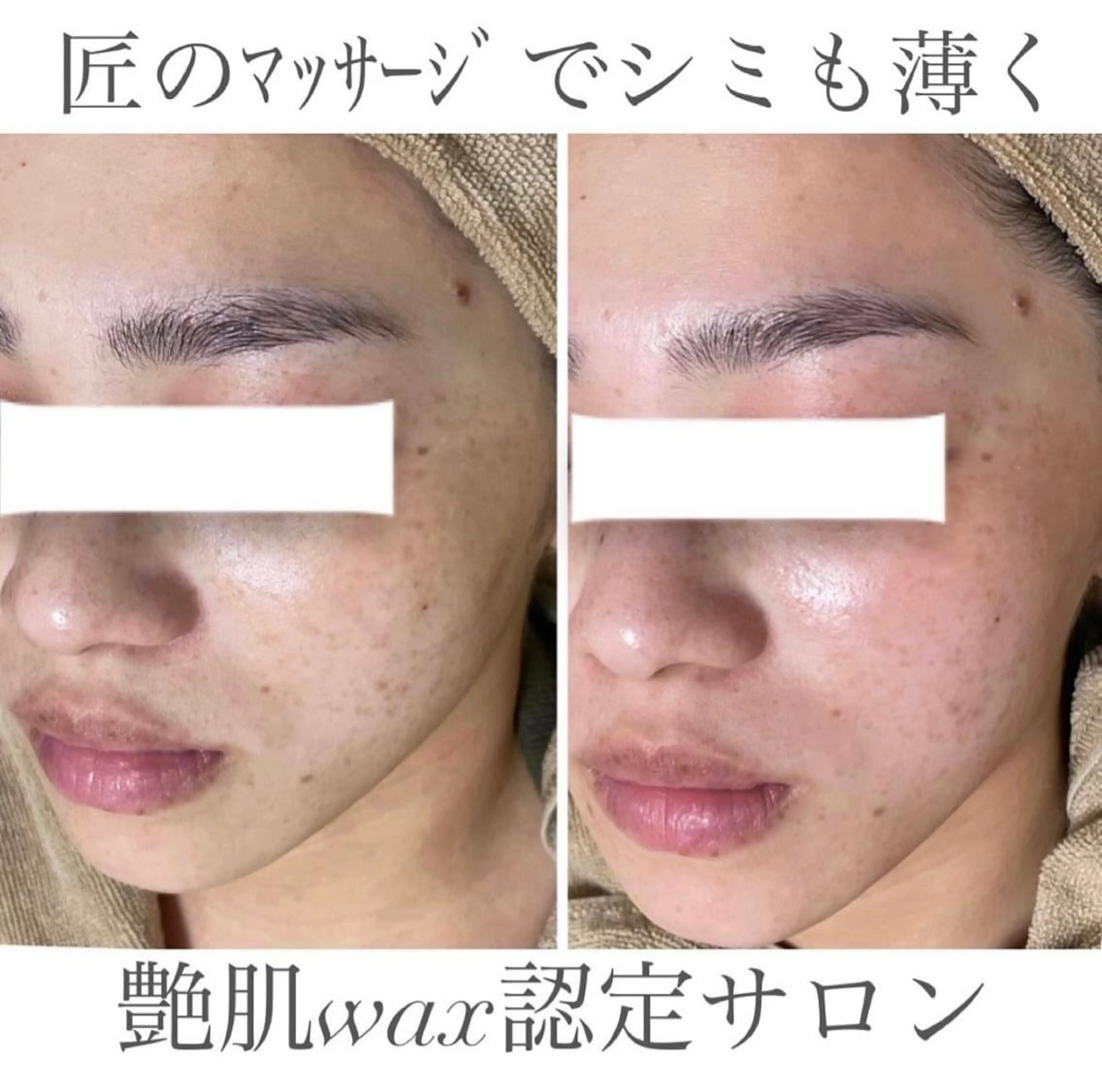 脱毛 エステサロン Mi-mi.iのエステ・リラクイメージ