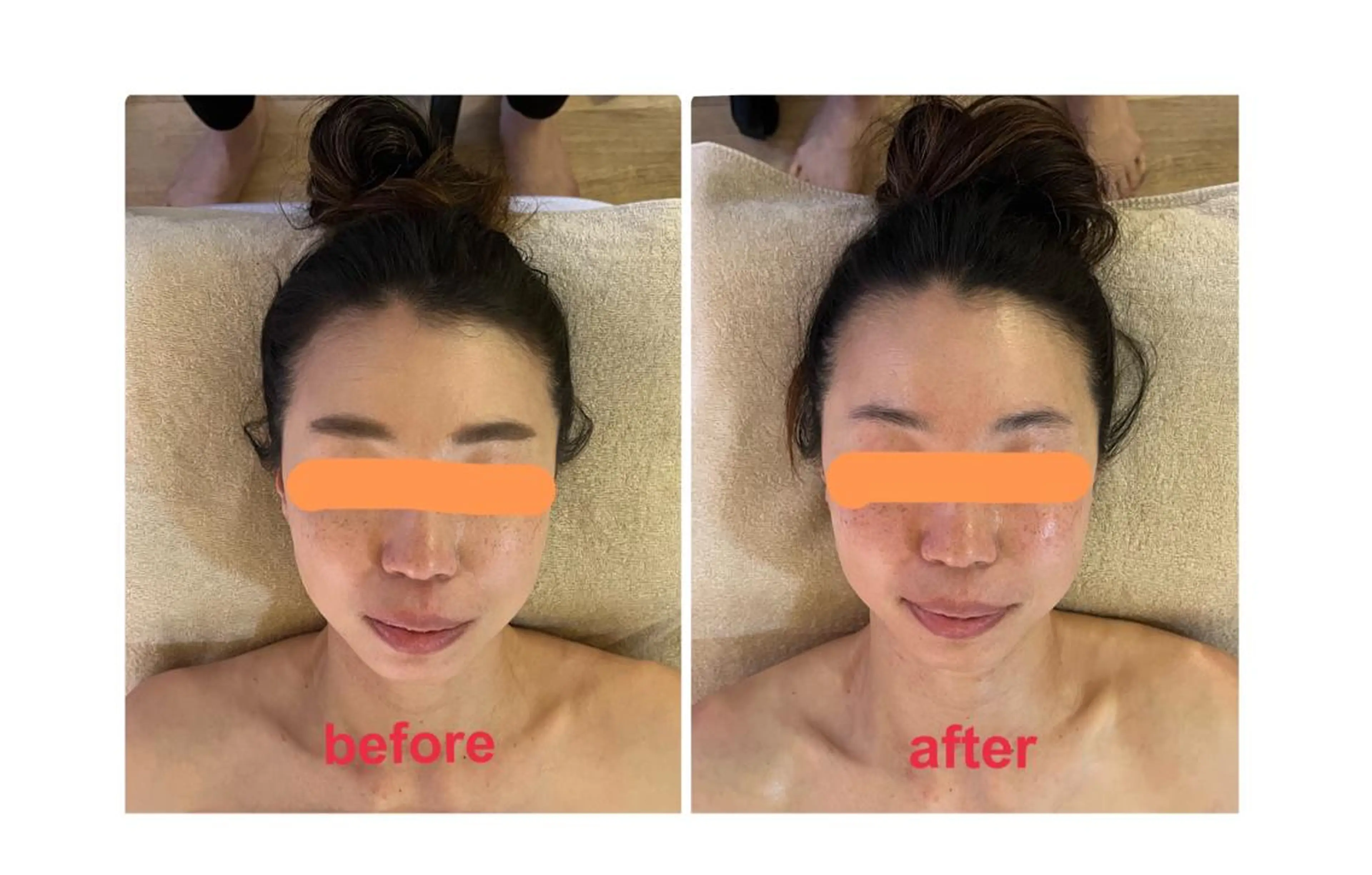 コルギ＆リラクゼーション　Acorde所属・小顔・巻肩・猫背ケア コルギ　Acordeのエステ・リラクイメージ